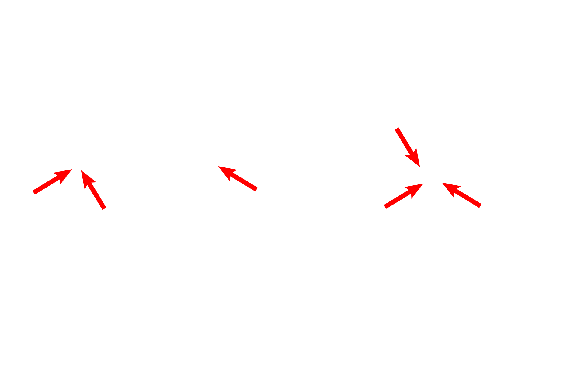 Semicircular canals > <p>The semicircular canals are three tunnels that form the posterolateral portion of the osseous labyrinth. Each canal is oriented in a plane that is mutually perpendicular to the other canals. The portion of the membranous labyrinth housed within each semicircular canal is the semicircular duct, containing a crista ampullaris, the receptor for angular acceleration.</p>
