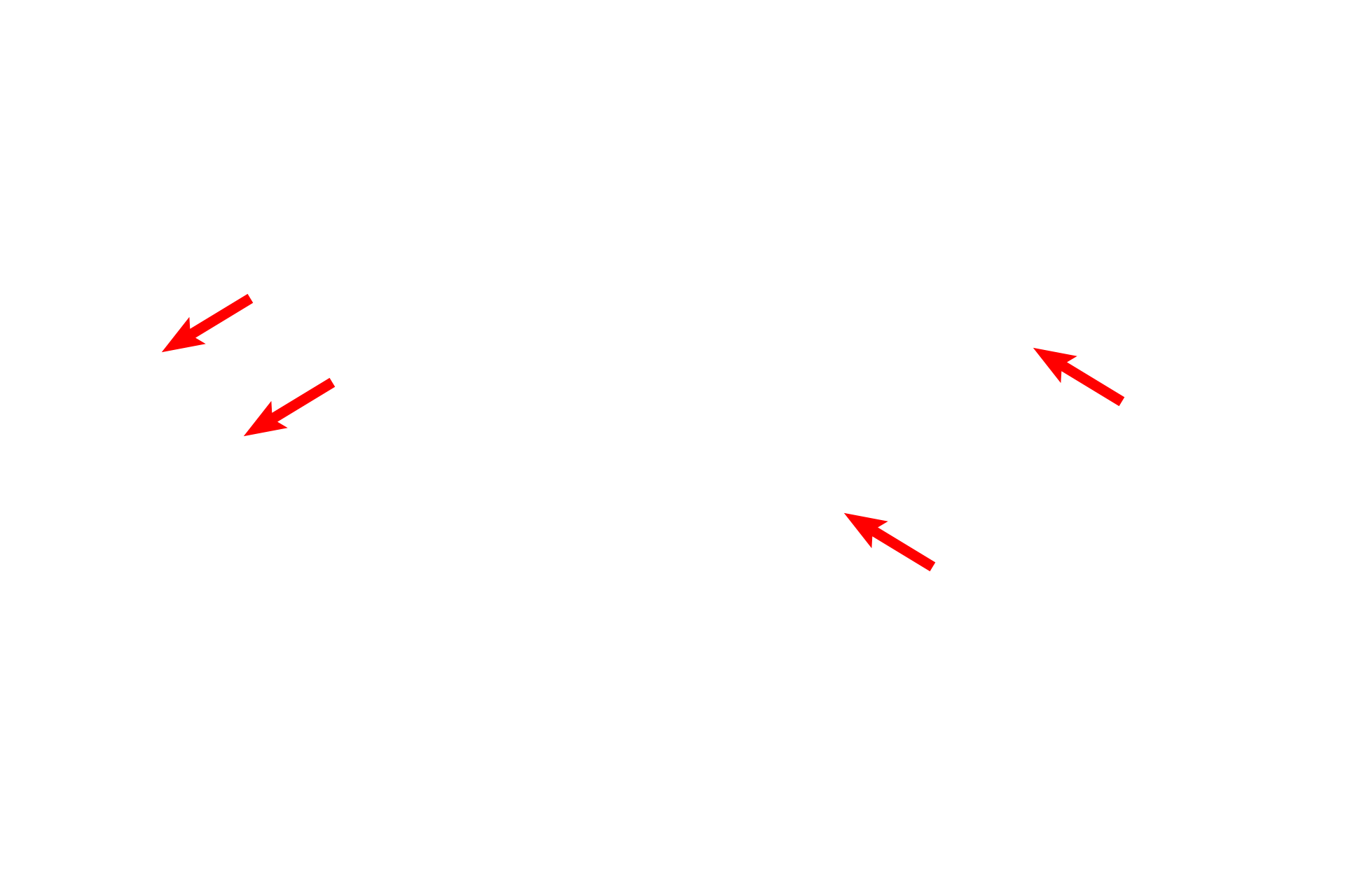 Temporal bone > <p>The inner ear is housed in the petrous portion of the temporal bone.</p>
