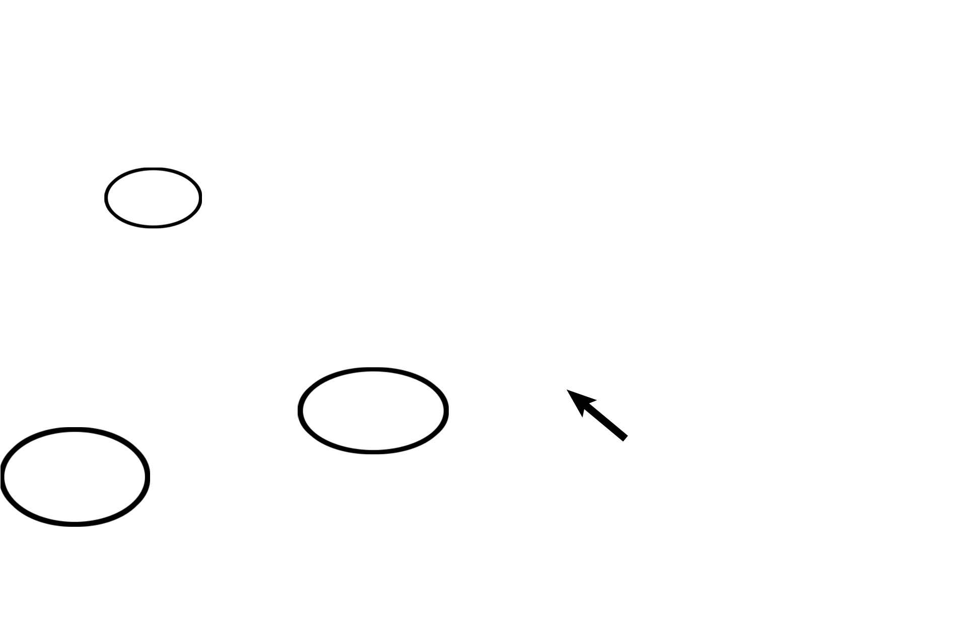 Cochlear duct > <p>The cochlear duct, part of the membranous labyrinth, is triangular in shape and is centrally located within the spiraling cochlea. Its central position compartmentalizes the cochlea into a scala vestibuli above the cochlear duct and a scala tympani below. The receptor for sound, the organ of Corti, a specialized neuroepithelium, lies in the floor of the cochlear duct.</p>
