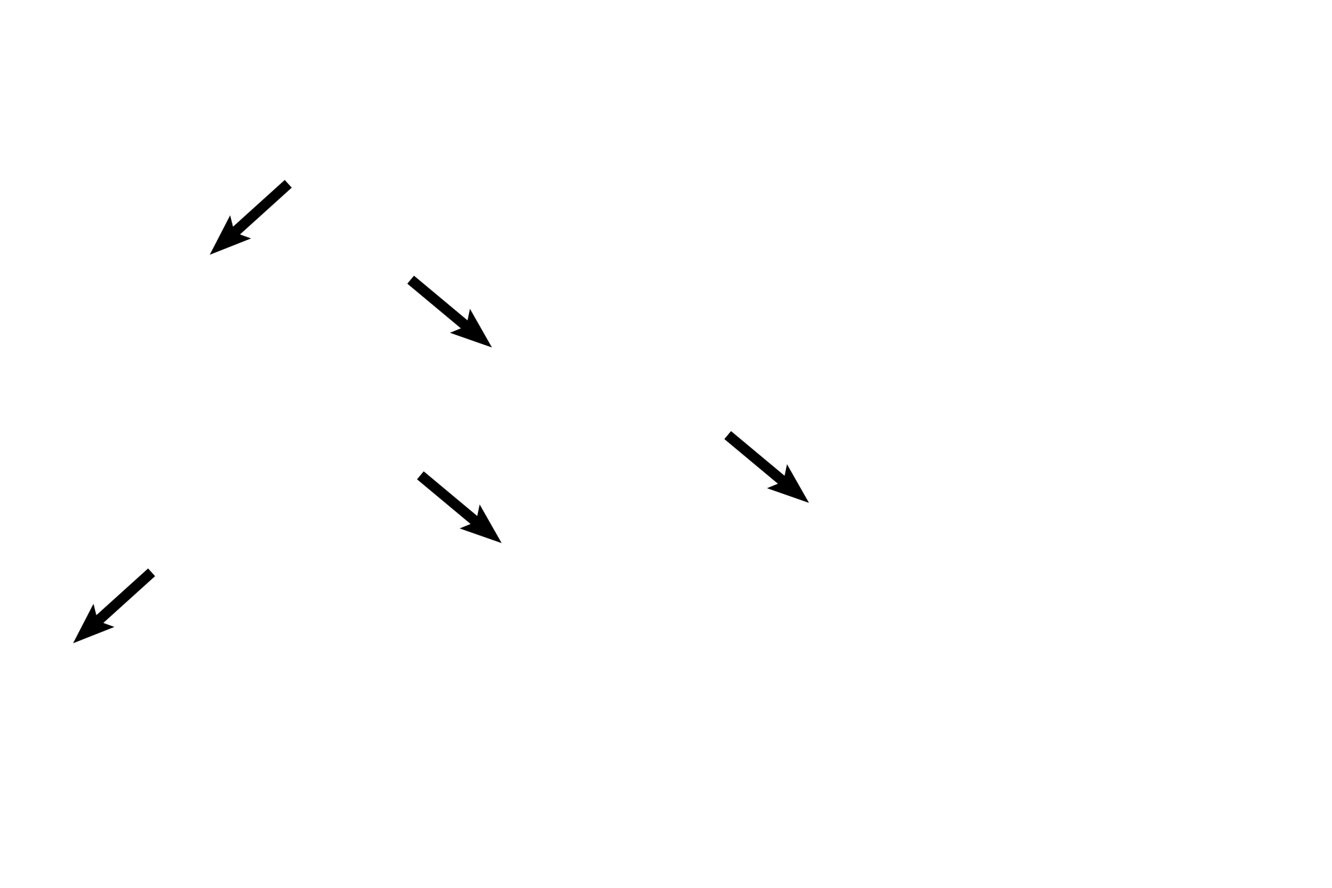 Vestibular membrane <p>The scala vestibuli (black arrows) lies above the cochlear duct and is continuous (red arrow) with the vestibule, hence its name. Scala vestibuli is part of the osseous labyrinth and, therefore, is filled with perilymph. Scala vestibuli is separated from the cochlear duct by the vestibular membrane.</p>
