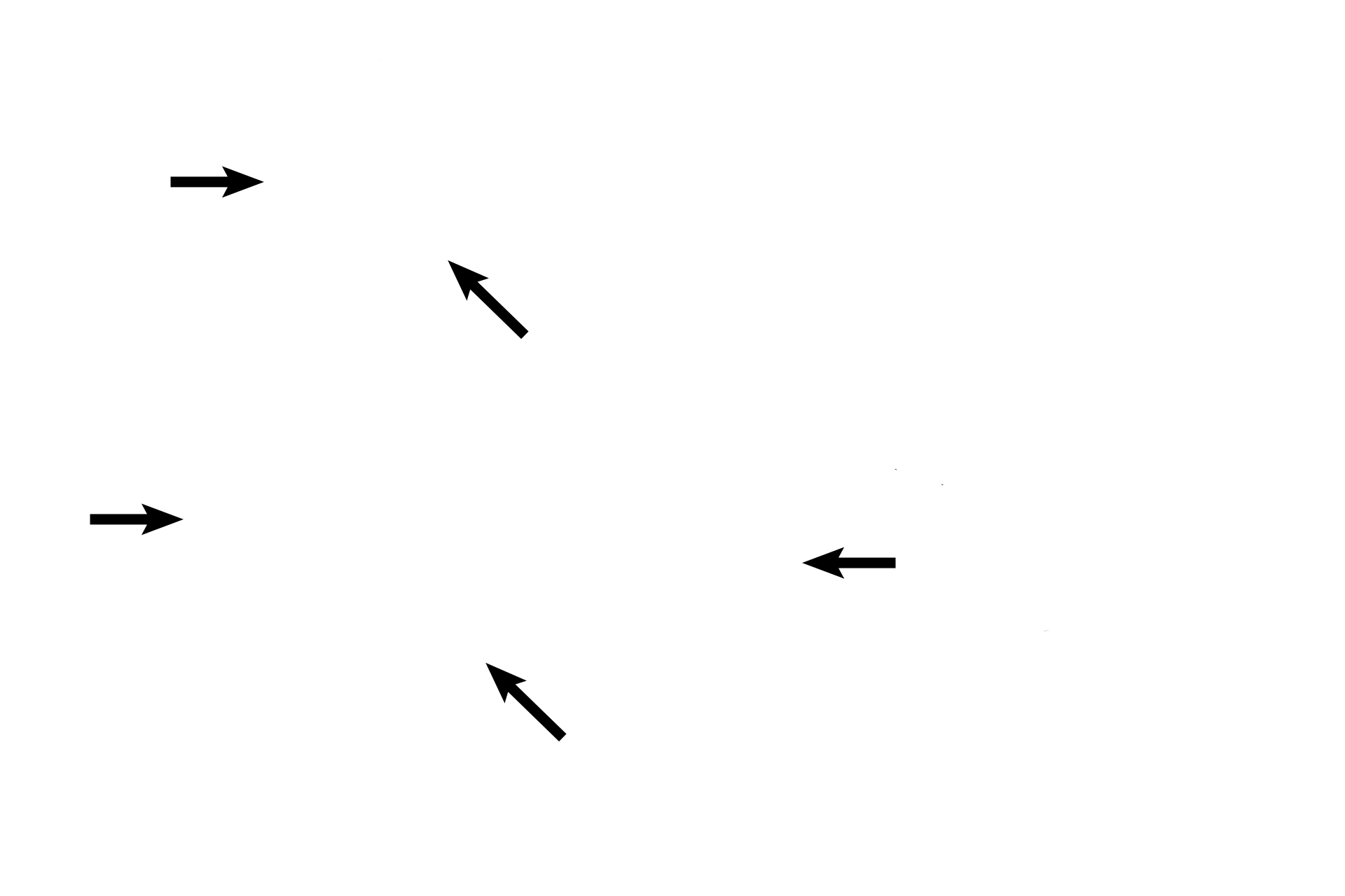 Scala tympani > <p>The scala tympani (black arrows) lies below the cochlear duct and is continuous with scala vestibuli at the helicotrema. Scala tympani is part of the osseous labyrinth and, therefore, is filled with perilymph. Scala tympani is separated from the cochlear duct by the basilar membrane.</p>
