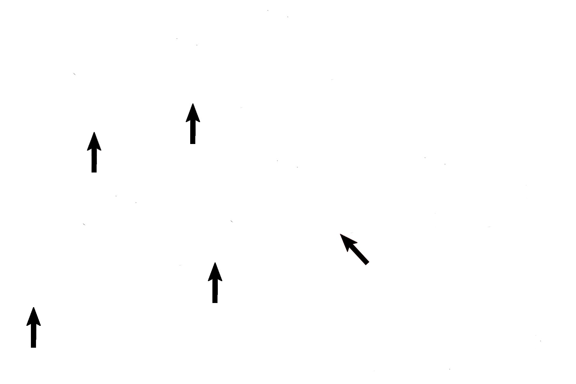 Basilar membrane <p>The scala tympani (black arrows) lies below the cochlear duct and is continuous with scala vestibuli at the helicotrema (red arrows). Scala tympani is part of the osseous labyrinth and, therefore, is filled with perilymph. Scala tympani is separated from the cochlear duct by the basilar membrane.</p>
