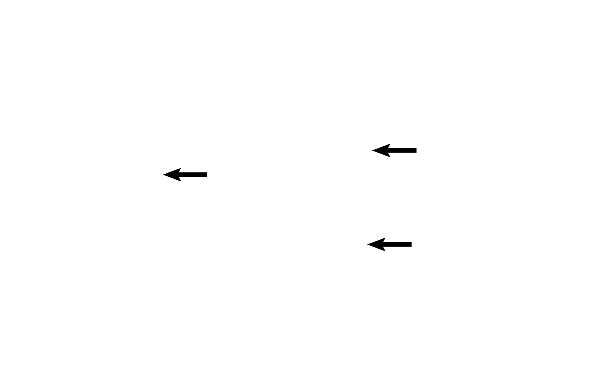 Stapes <p>Vibrations of the vestibular membrane are transmitted through the malleus and incus to the stapes. The stapes is seated in the oval window between the middle ear and the vestibule of the inner ear. Inward movement of the stapes creates pressure on the perilymph filling the osseous labyrinth, initiating responses in neural receptors of the cochlear duct.</p>
