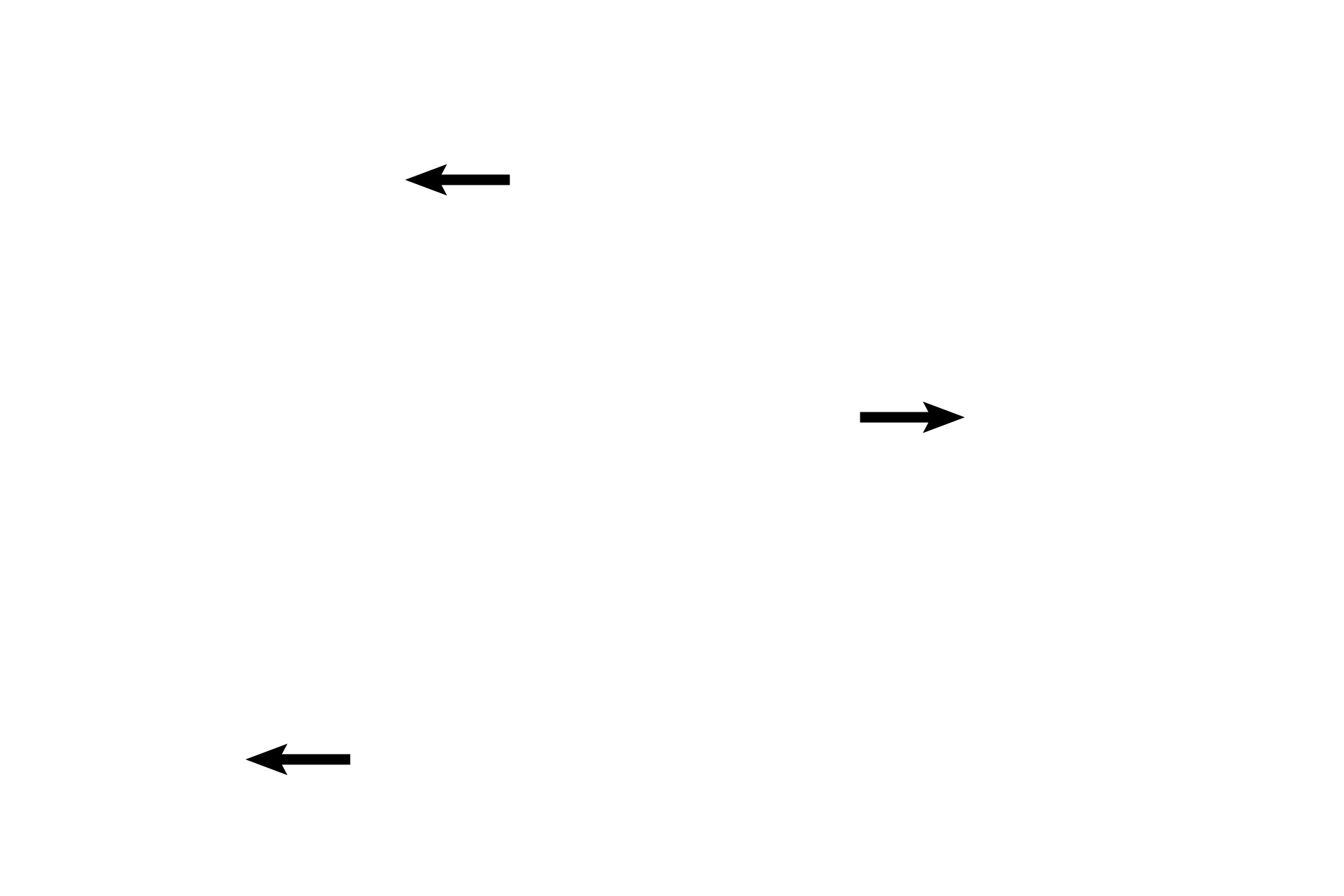  - Smooth muscle <p>This terminal bronchiole (from a non-human source) displays abundant club cells, a prominent smooth muscle layer and obvious bronchial vessels supplying the tissues of the bronchiole.</p>
