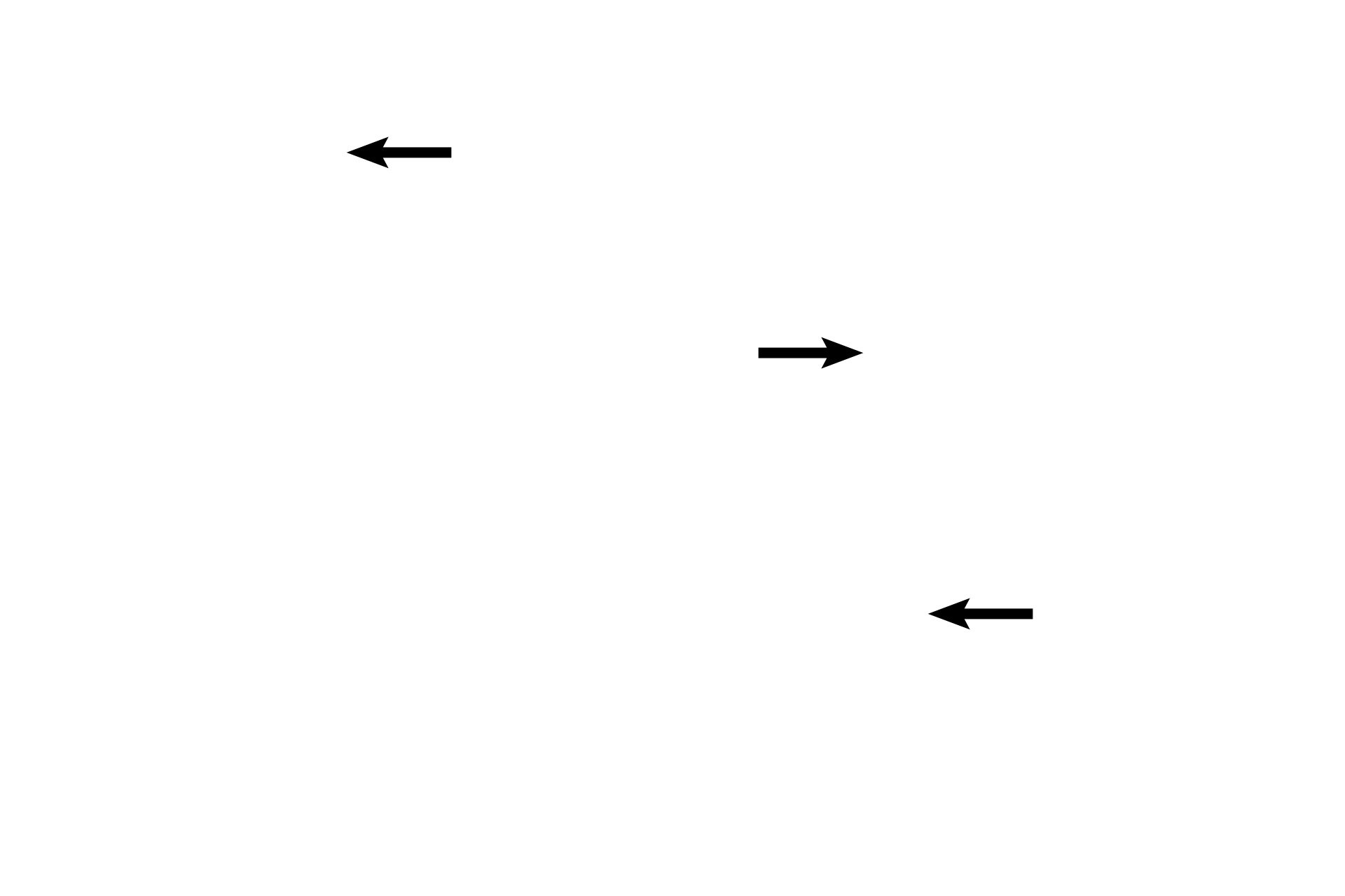  - Bronchial blood vessels <p>This terminal bronchiole (from a non-human source) displays abundant club cells, a prominent smooth muscle layer and obvious bronchial vessels supplying the tissues of the bronchiole.</p>

