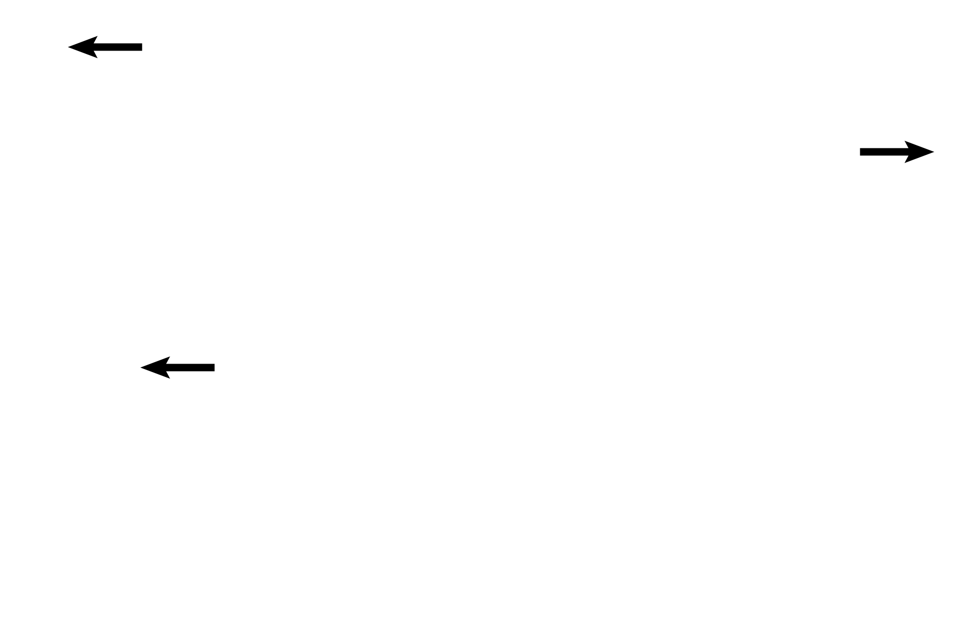 Alveoli > <p>The presence of alveoli indicates that all the structures visible here are intrapulmonary.</p>
