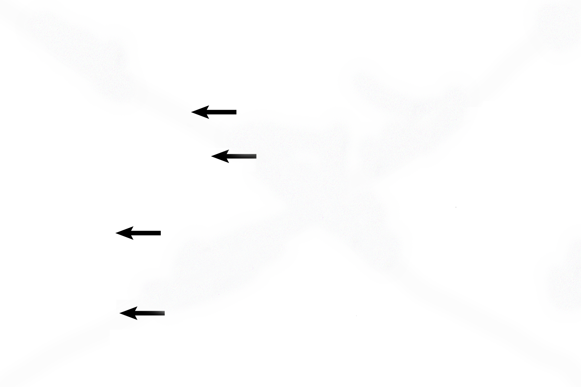  - Endothelial nuclei <p>A single alveolus is seen attached to a pair of knobs forming part of the wall of an alveolar duct. An interalveolar septum separates adjacent alveoli. Capillaries bulge into an alveolus from the interalveolar septa, thus increasing the surface area for gaseous exchange. 1000x</p>
