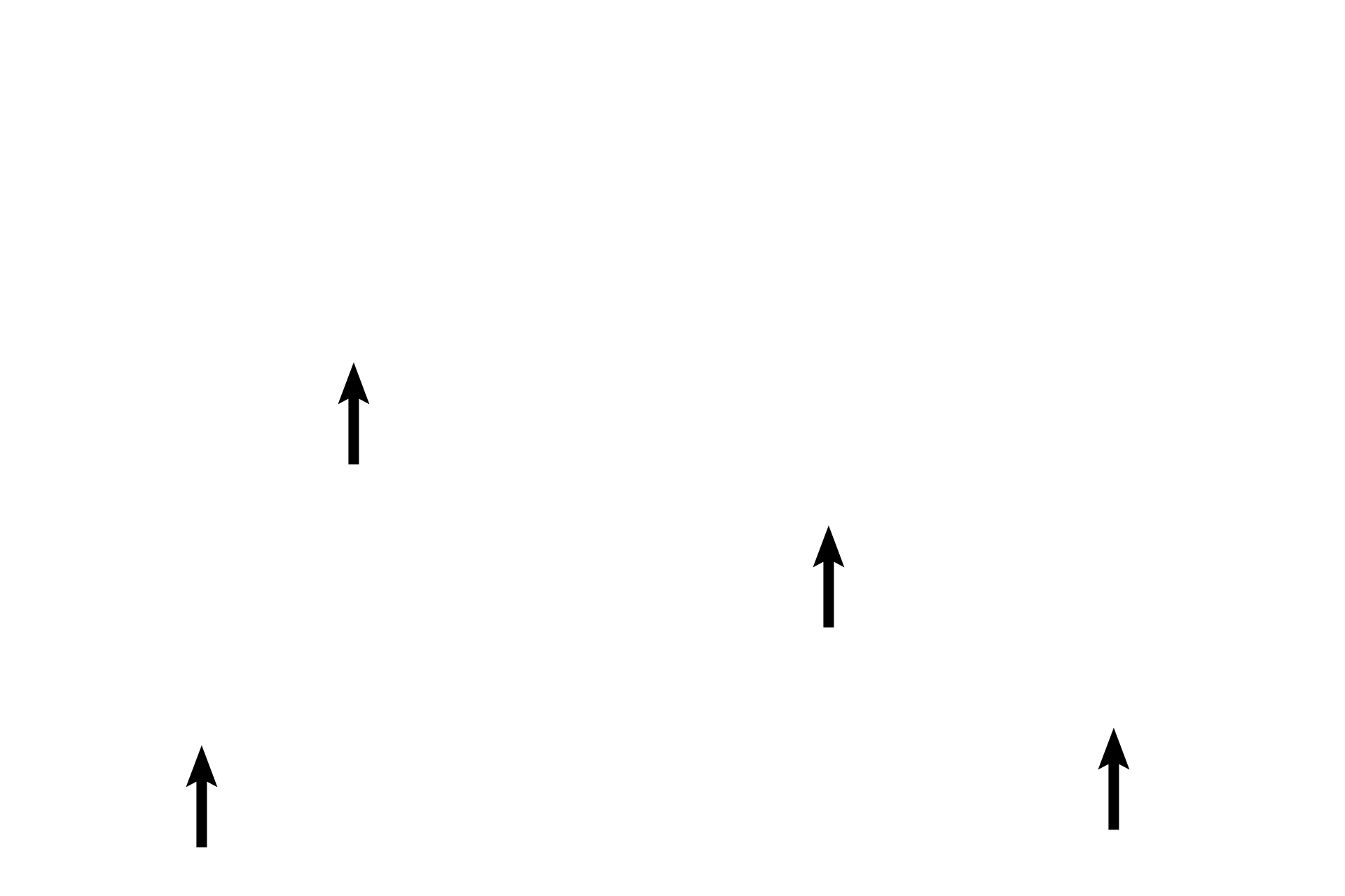  -- Luminal subdivisions <p>An enlargement of the previous image demonstrates how the central lumen has been partitioned by the primary, secondary and tertiary arches formed by the mucosal folds in this gland. 100x</p>
