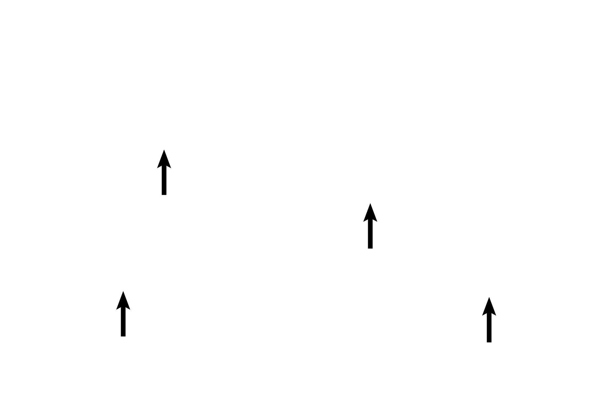  - Arcades <p>An enlargement of the previous image demonstrates how the central lumen has been partitioned by the primary, secondary and tertiary arches formed by the mucosal folds in this gland. 100x</p>
