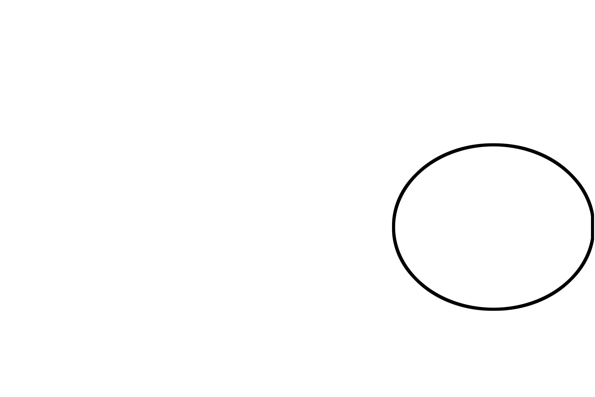 Spiral ganglion <p>The image illustrates the course of peripheral processes of cranial nerve VIII from their passage through the osseous spiral lamina to the spiral ganglion. Central axons from the bipolar cells in this ganglion continue into the modiolus as the cochlear division of the nerve. 200x </p>
