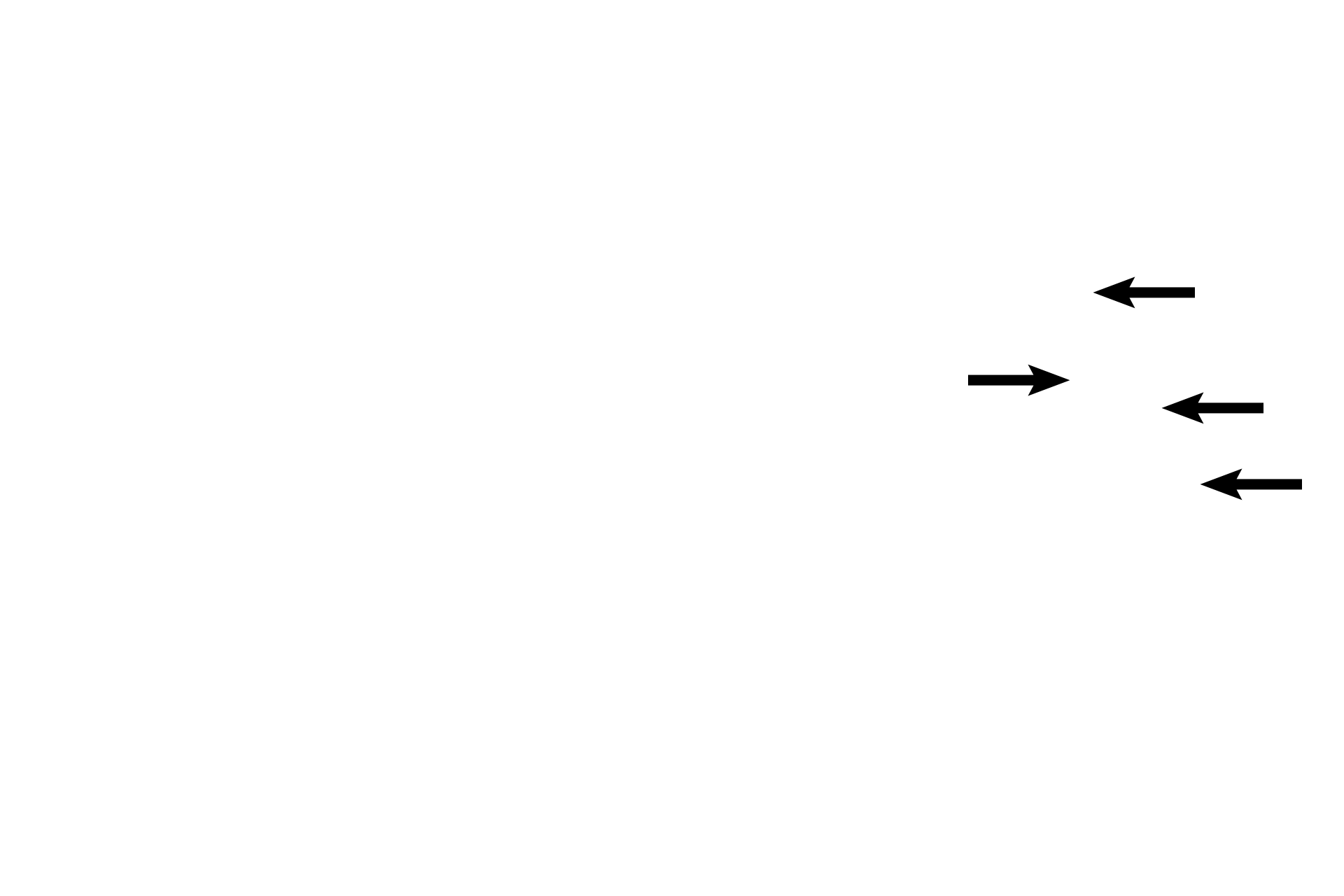 Bipolar neurons <p>Peripheral dendrites of the vestibulocochlear nerve (CN VIII) innervate hair cells of the organ of Corti and then pass medially through the osseous spiral lamina to the spiral ganglion, location of their bipolar nerve cell bodies. Central axons form the cochlear division of the nerve. The modiolus with its osseous spiral lamina provides a framework for the cochlea and a conduit for the nerve. 40x, 200x.</p>
