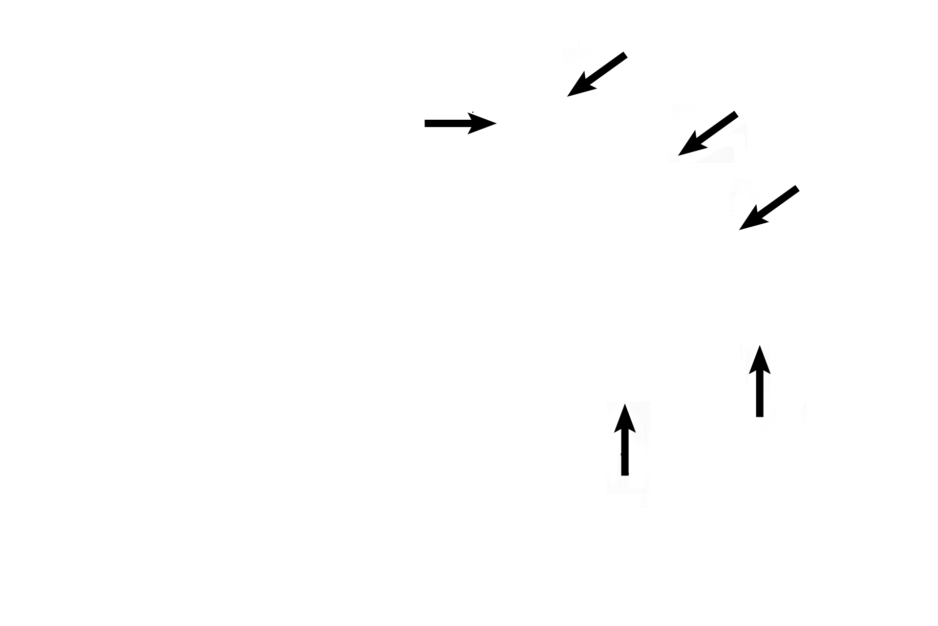  - Semicircular ducts  > <p>The three semicircular ducts, located in their semicircular canals, are oriented in perpendicular planes to each other. The opening at each end of two ducts joins with the utricle; the third duct opens into another duct. An enlargement in one end of each semicircular duct, the ampulla, houses the receptor for that duct, the crista ampullaris.</p>
