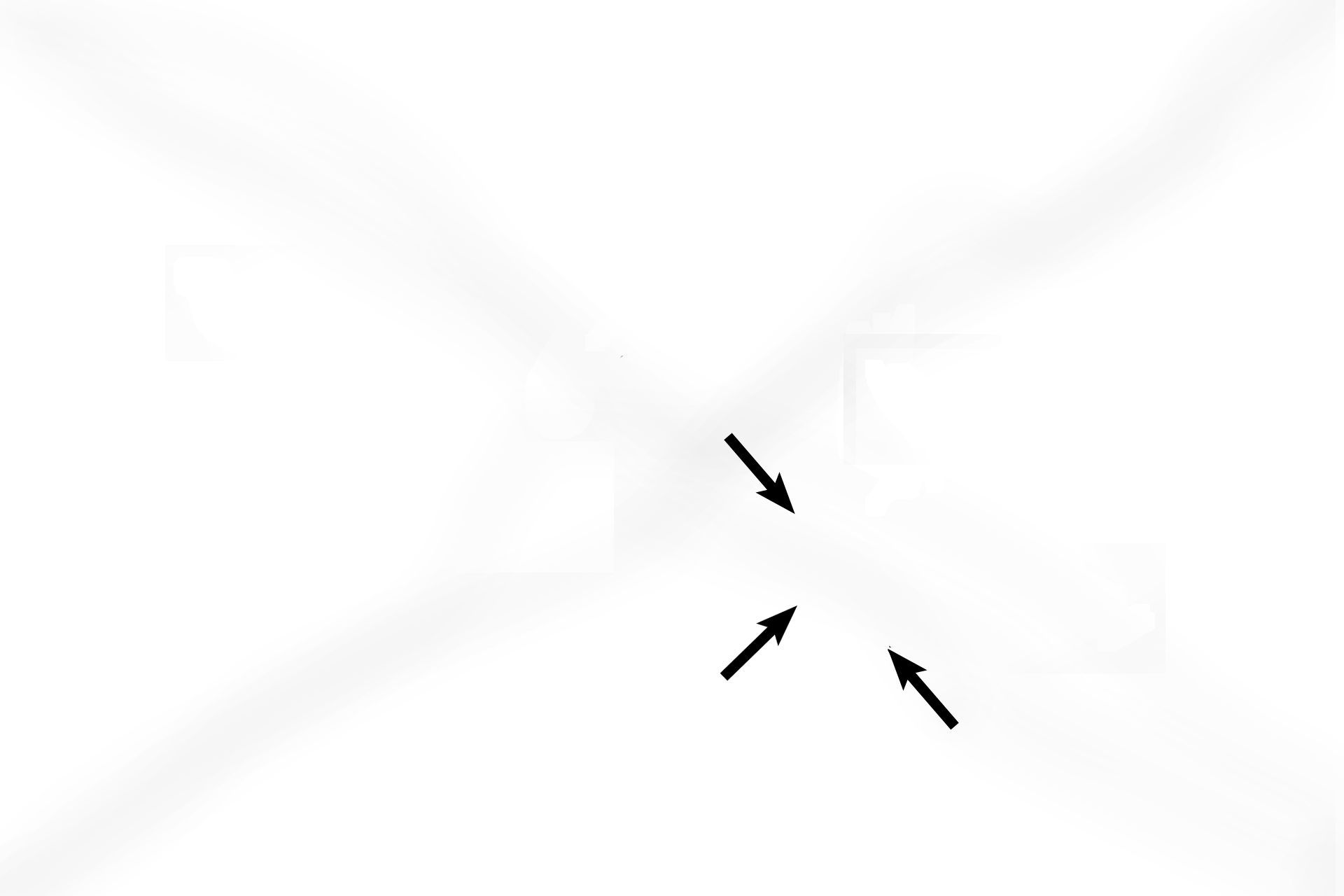 - Cochlear duct <p>The cochlea, part of the osseous labyrinth, consists of a long, hollow tube that is coiled into a spiral, resembling a snail shell. The cochlear duct, the membranous labyrinth in the cochlea, lies in the middle of the cochlea, dividing it into thirds. The cochlear duct houses the organ of Corti, the receptor for audition or hearing.</p>
