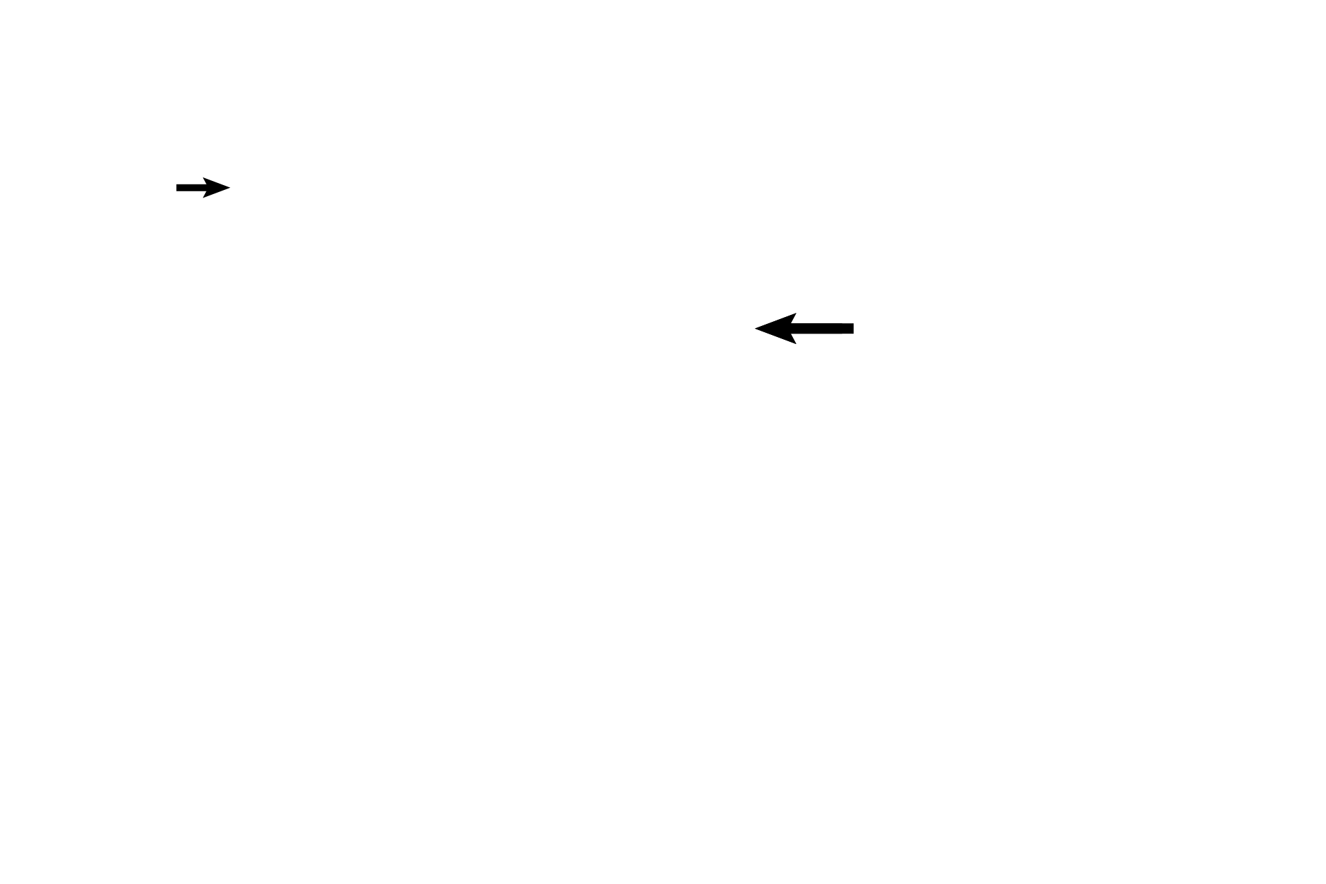 Utricle <p>Three membranous semicircular ducts are shown. One is visible at its attachment with the utricle, just beginning to enter its semicircular canal. The second is sectioned at a distance from the utricle, lying in its bony semicircular canal. The third semicircular duct is represented by its ampulla and the enclosed crista ampullaris. 30x</p>

