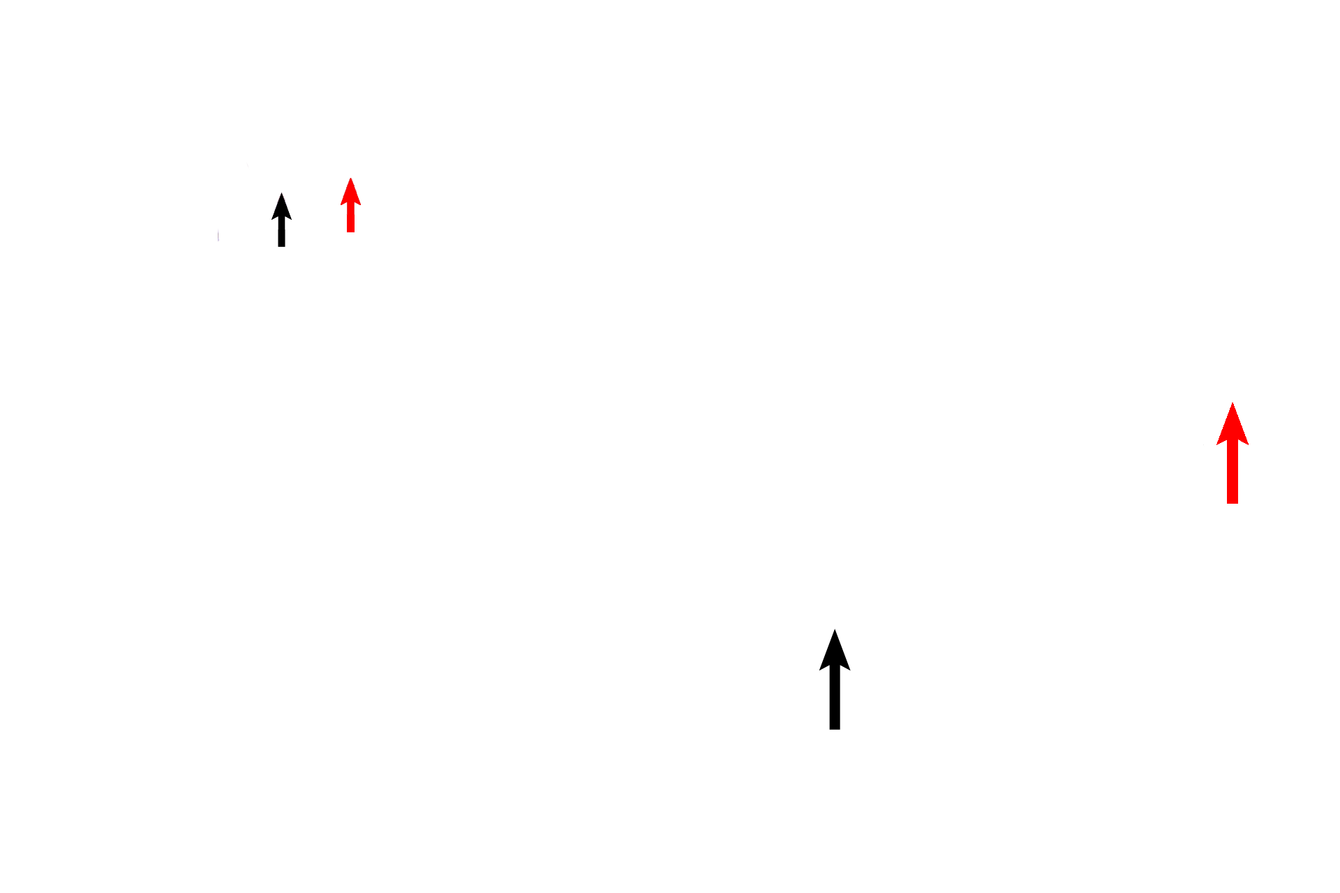 Semicircular ducts > <p>One semicircular duct (black arrow) is still attached to the utricle, just beginning to enter its semicircular canal. A second duct (red arrow) has already exited from the vestibule and lies in its bony semicircular canal. </p>

