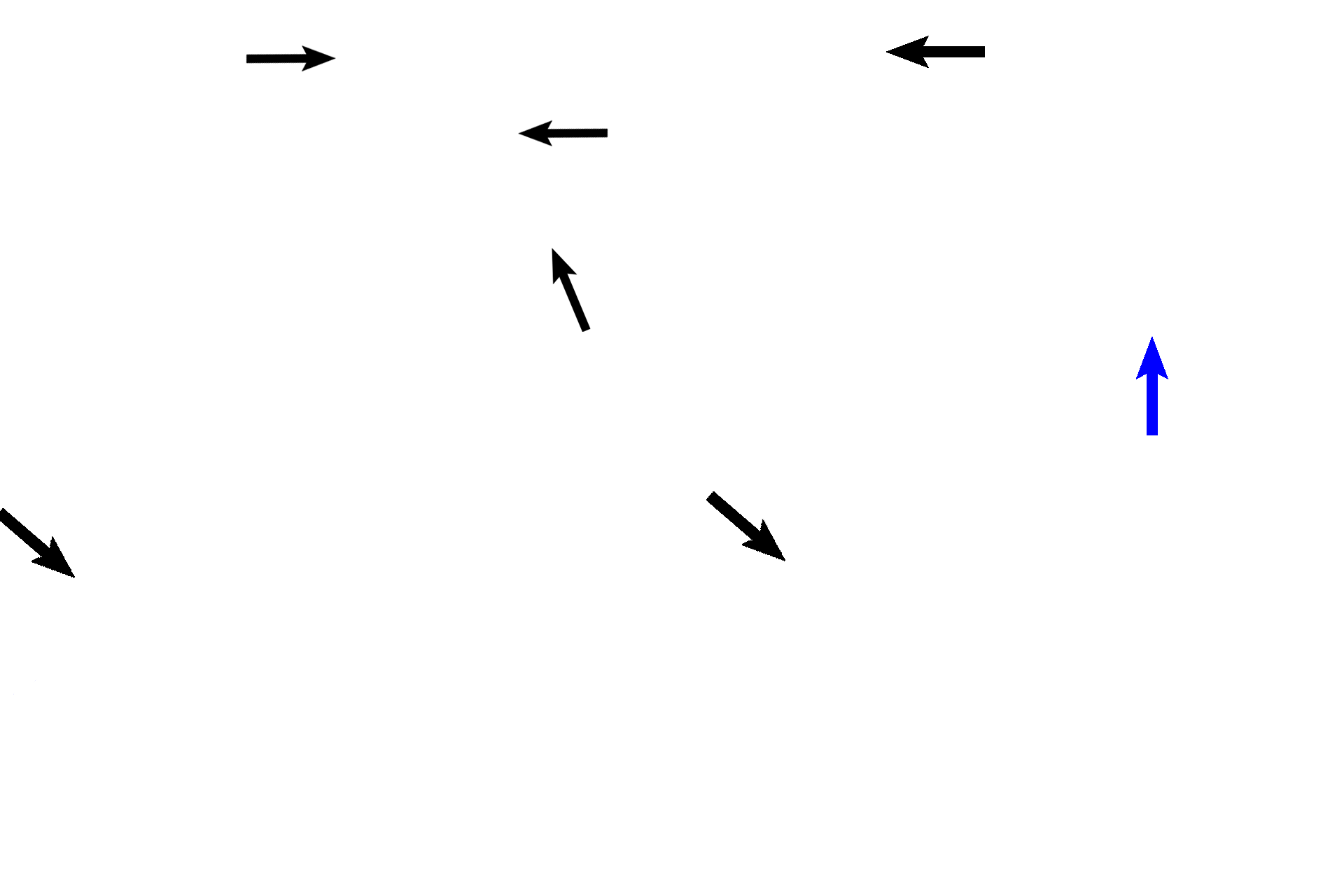 Semicircular canals > <p>Portions of three semicircular canals (black arrows, osseous labyrinth), are shown at or near their connections with the vestibule. The fourth canal (blue arrow) is shown extending some distance from the vestibule.</p>
