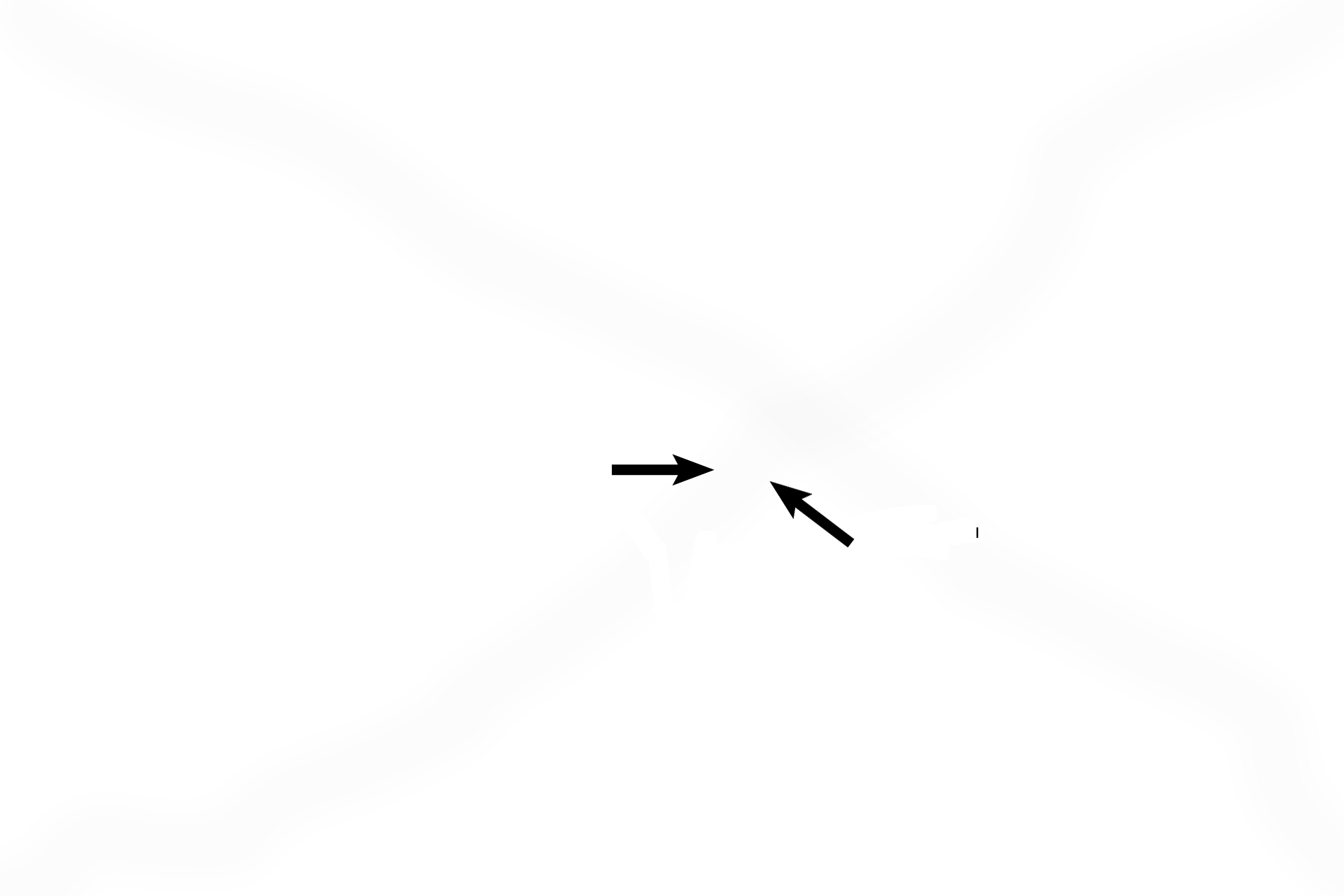 Utricle <p>The vestibule, a portion of the osseous labyrinth, is a space in the petrous portion of the temporal bone, filled with perilymph. The utricle and saccule are the components of the membranous labyrinth located in the vestibule. Each possesses a macula, the receptor that responds to linear acceleration and gravitational forces. </p>
