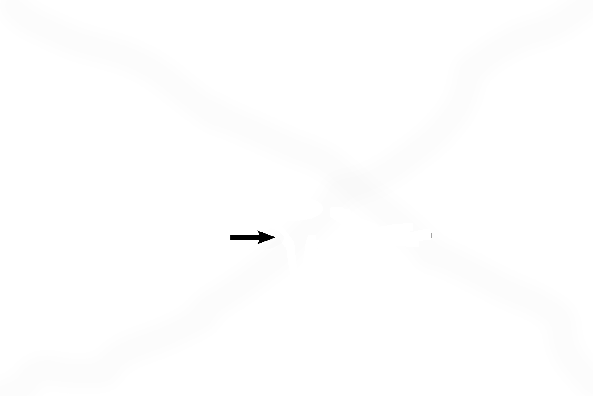 Saccule <p>The vestibule, a portion of the osseous labyrinth, is a space in the petrous portion of the temporal bone, filled with perilymph. The utricle and saccule are the components of the membranous labyrinth located in the vestibule. Each possesses a macula, the receptor that responds to linear acceleration and gravitational forces. </p>
