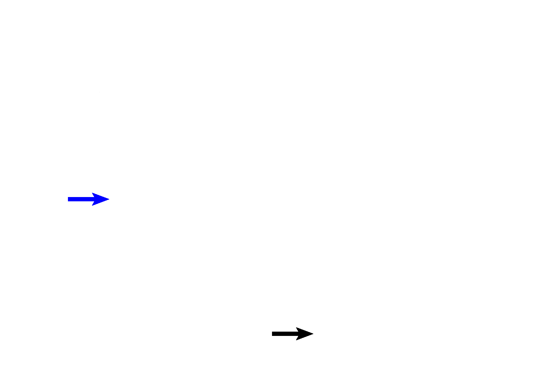 Semicircular ducts > <p>A portion of one (blue arrow) of the three semicircular ducts (membranous labyrinth) is sectioned at its attachment to the utricle. A second semicircular duct (black arrow) is seen a short distance from its utricular attachment.</p>
