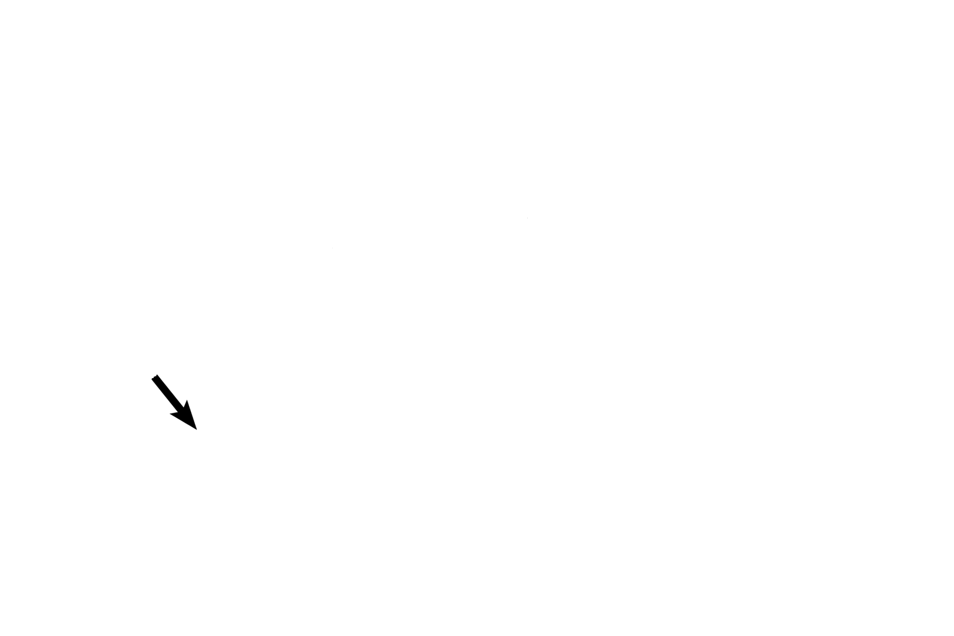 Eustachian tube > <p>The middle ear communicates with the pharynx anteriorly through the auditory (Eustachian) tube and with the mastoid air cells posteriorly.</p>
