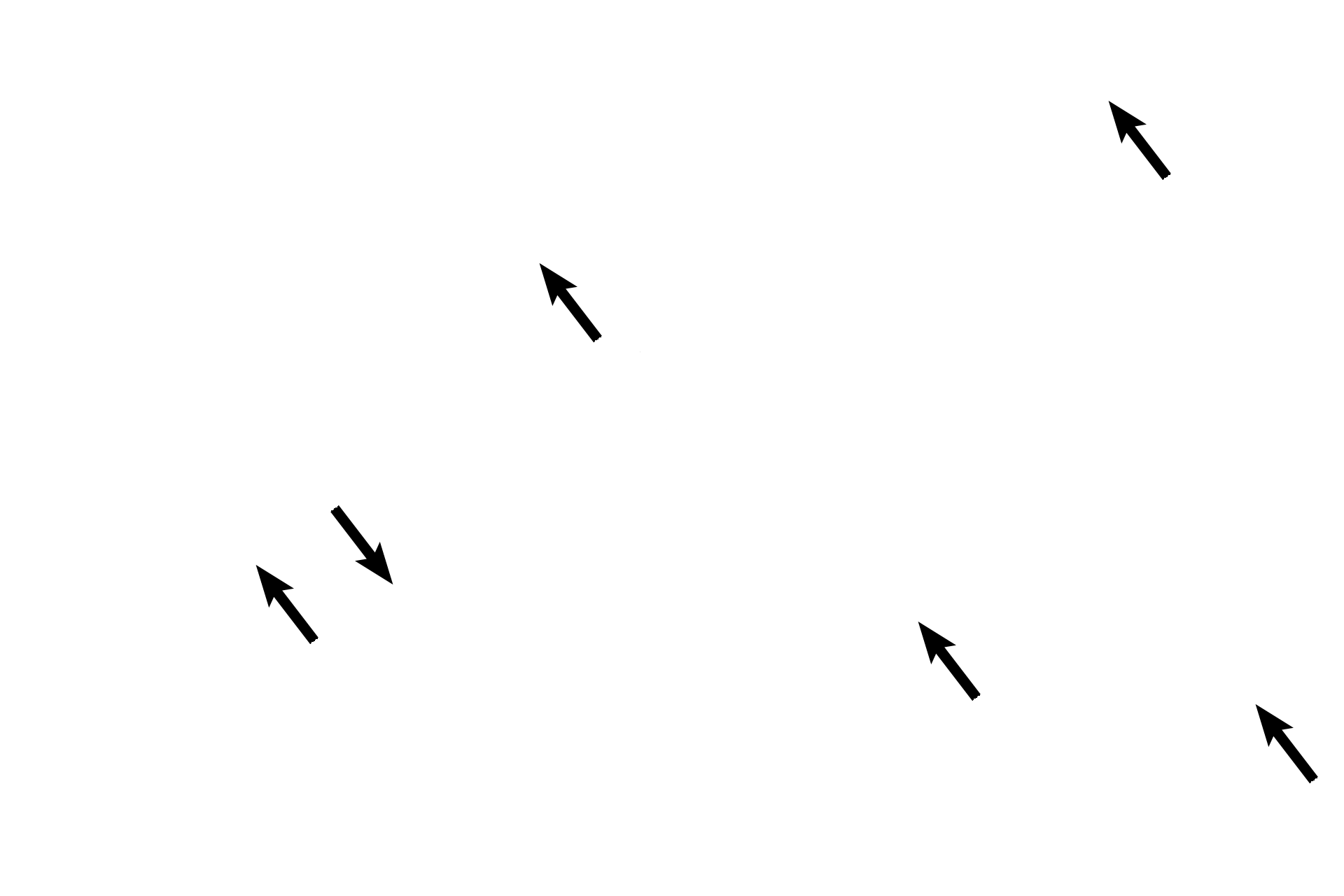 Mucosa <p>The middle ear, a cavity in the temporal bone, is lined by a mucosa whose epithelium is primarily simple squamous. The middle ear is bounded by the tympanic membrane laterally and the bony wall of the inner ear medially. It communicates with the mastoid air cells posteriorly and with the nasopharynx, via the Eustachian tube, anteriorly. 10x</p>
