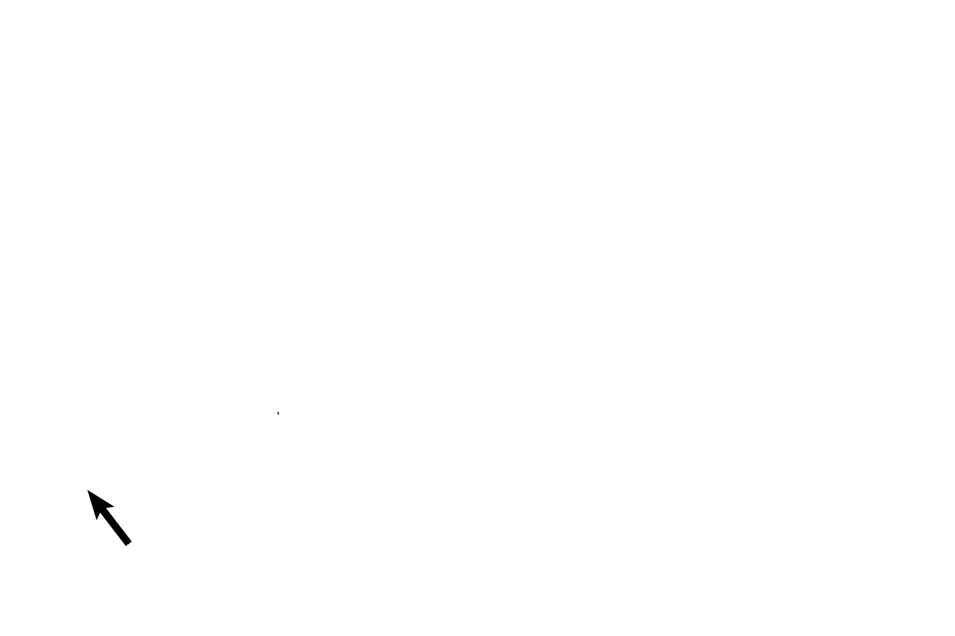 Eustachian tube <p>The middle ear, a cavity in the temporal bone, is lined by a mucosa whose epithelium is primarily simple squamous. The middle ear is bounded by the tympanic membrane laterally and the bony wall of the inner ear medially. It communicates with the mastoid air cells posteriorly and with the nasopharynx, via the Eustachian tube, anteriorly. 10x</p>
