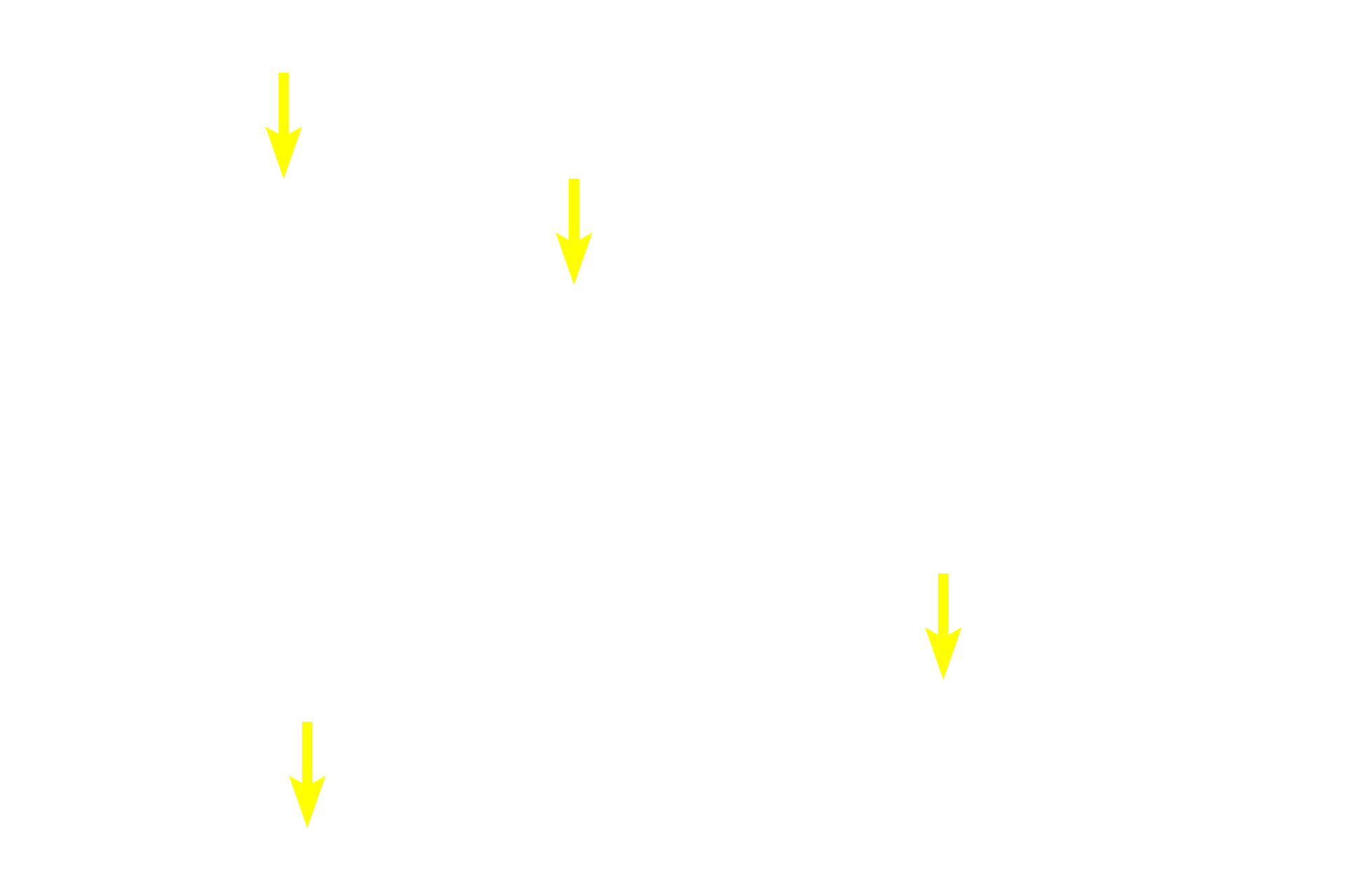  - Intralobular ducts <p>This portion of a single lobule consists entirely of acini.  The ducts draining the acini gradually increase in diameter and their lining epithelia gently transition from low cuboidal to columnar.  These ducts, called intralobular, are located within the lobule, surrounded by secretory they units.  They join to form interlobular ducts that exit the lobule surrounded by connective tissue and are lined by a stratified columnar epithelium.  100x</p>
