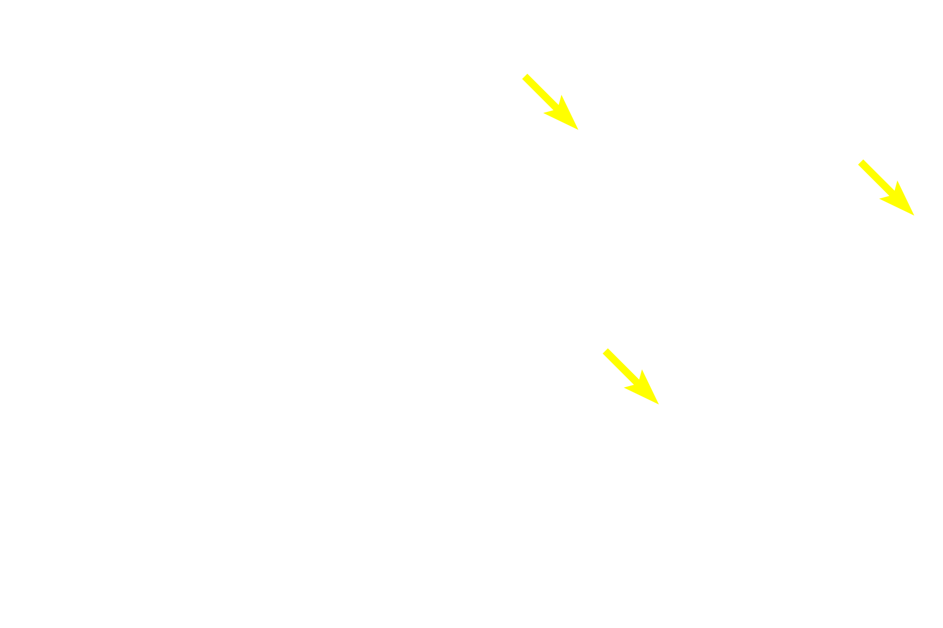 Intralobular connective tissue <p>Intralobular ducts are surrounded by glandular parenchyma and are lined by a cuboidal or columnar epithelium.  Interlobular ducts are lined by a stratified columnar epithelium and anastomose with each other to form the main duct(s) connecting to the epithelium onto which secretions are released. 200x</p>
