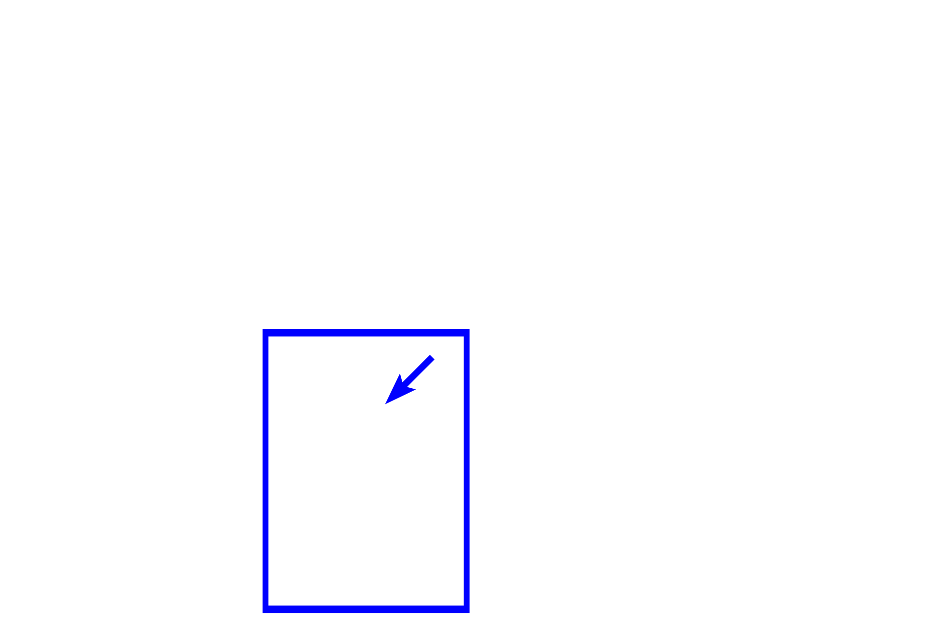  - Squamous dry > <p>Stratified squamous dry (or keratinized) epithelium is composed of multiple cell layers that flatten as they approach the surface.  These epithelial cells produce a cornified layer at the surface (arrow) that is composed of flattened, non-nucleated, dead cells filled with the protein keratin.  Stratified squamous keratinized epithelium covers the surface of the body forming the outer layer of the skin.</p>
