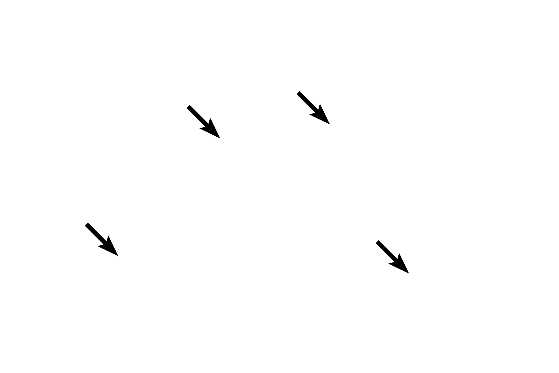 Myelinated axons <p>These cross sections show numerous myelinated axons of various sizes, as well as unmyelinated axons. In the peripheral nervous system, the myelin sheath is produced by Schwann cells. Note how the Schwann cell nucleus and cytoplasm conforms to the outer contours of the myelin. 1000x</p>
