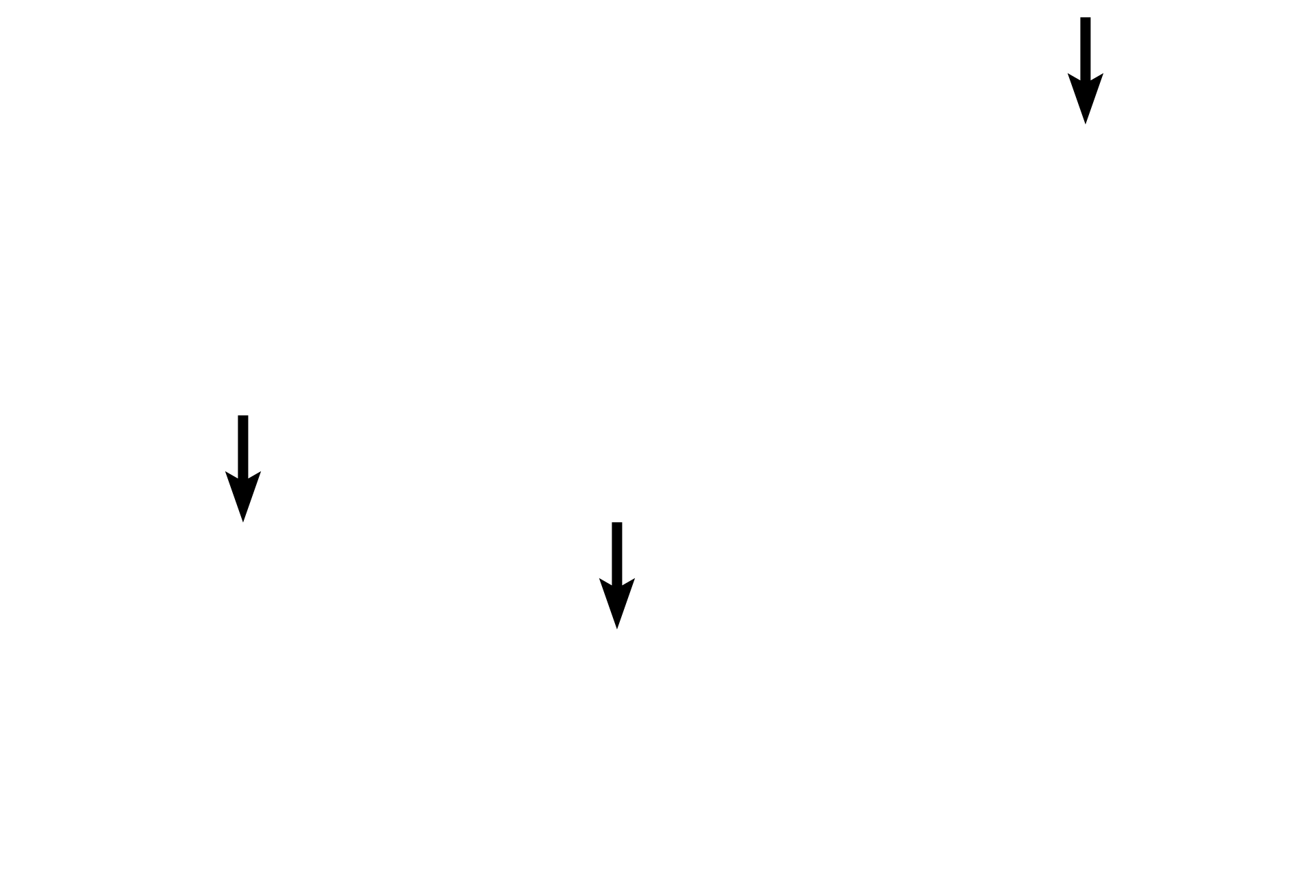 Unmyelinated axons <p>These cross sections show numerous myelinated axons of various sizes, as well as unmyelinated axons. In the peripheral nervous system, the myelin sheath is produced by Schwann cells. Note how the Schwann cell nucleus and cytoplasm conforms to the outer contours of the myelin. 1000x</p>
