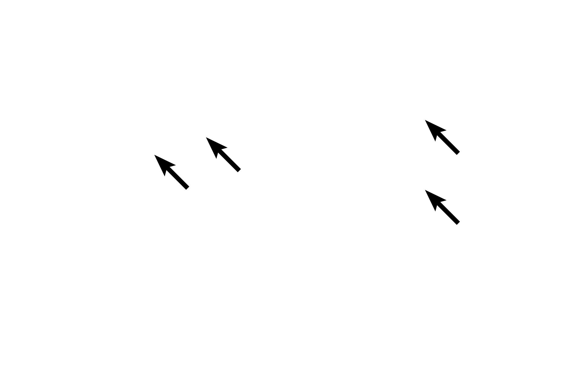 Endoneurium <p>The endoneurium is composed of fibroblasts and collagen fibrils interspersed between the Schwann cells and the axons they ensheath. Also present in the endoneurium are blood vessels, mast cells and macrophages.</p>
