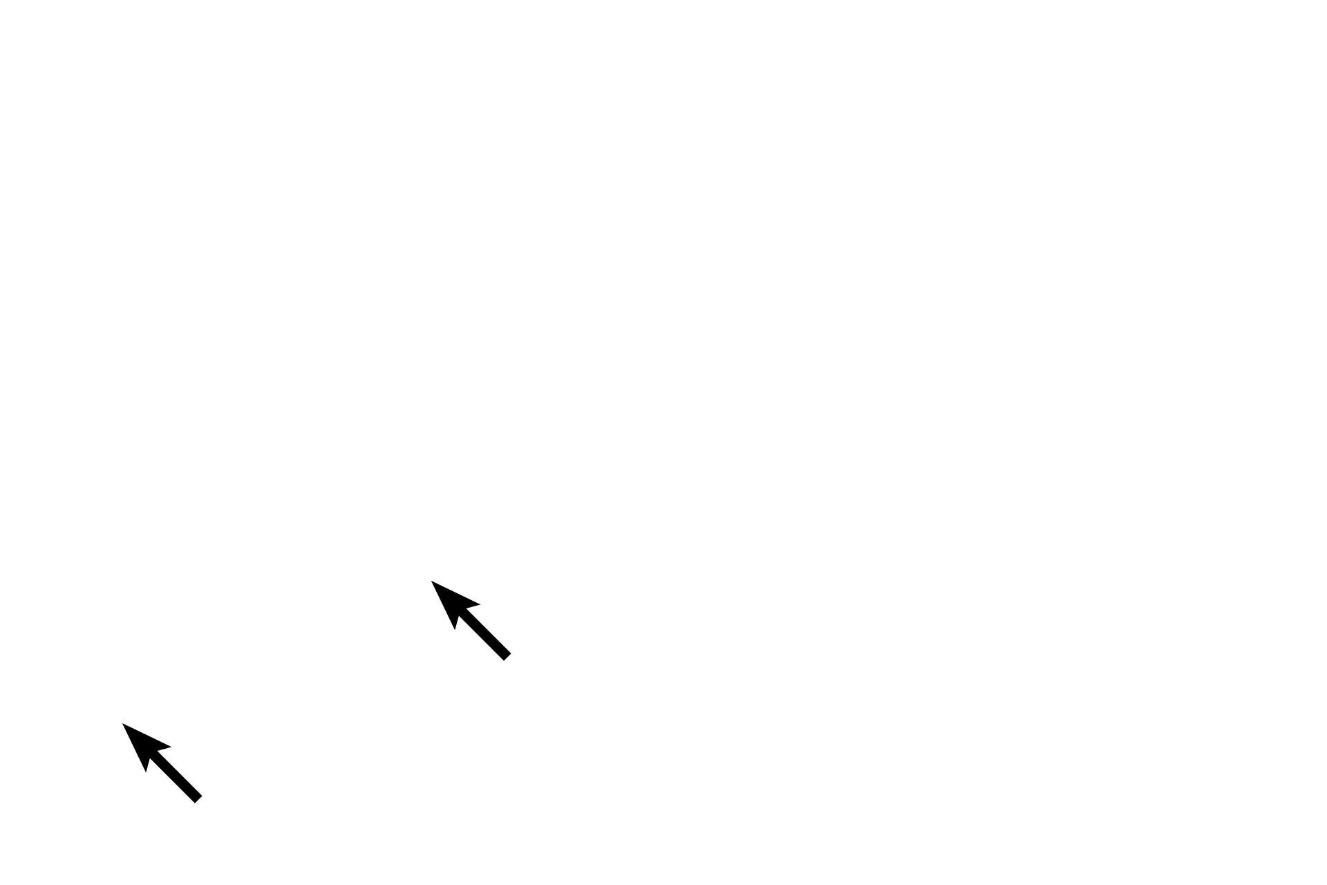 Blood vessels <p>The endoneurium is composed of fibroblasts and collagen fibrils interspersed between the Schwann cells and the axons they ensheath. Also present in the endoneurium are blood vessels, mast cells and macrophages.</p>
