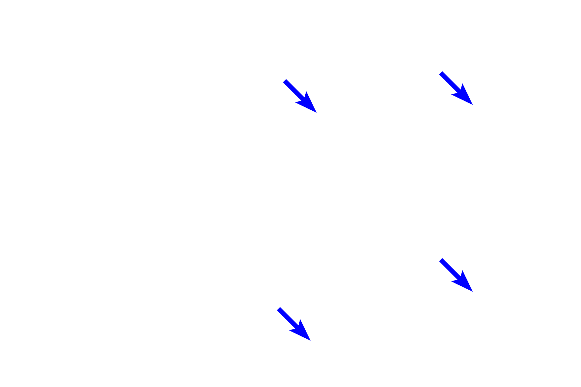  - Endothelium <p>The endocardium lines the heart chambers and is continuous with the tunica intima of blood vessels; it is thicker in the atria than in the ventricles.  The endocardium consists of an endothelium (simple squamous epithelium), an underlying layer of subendothelial connective tissue that may also contain smooth muscle fibers, and a deeper layer of subendocardial connective tissue.  Elements of the conducting system of the heart, Purkinje fibers, are located in the subendocardial connective tissue layer.  10x, 400x, 400x</p>
