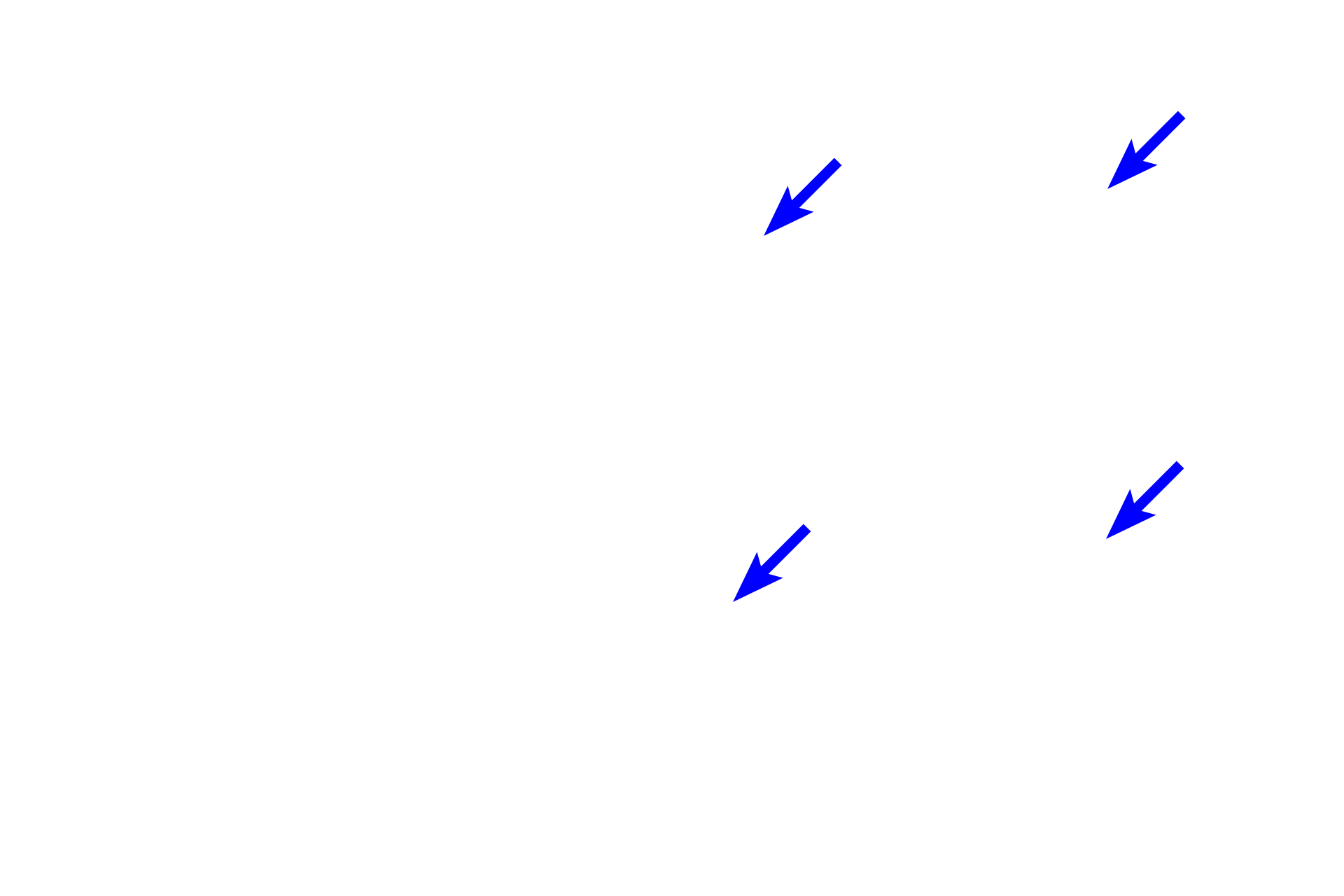  - Subendothelial connective tissue <p>The endocardium lines the heart chambers and is continuous with the tunica intima of blood vessels; it is thicker in the atria than in the ventricles.  The endocardium consists of an endothelium (simple squamous epithelium), an underlying layer of subendothelial connective tissue that may also contain smooth muscle fibers, and a deeper layer of subendocardial connective tissue.  Elements of the conducting system of the heart, Purkinje fibers, are located in the subendocardial connective tissue layer.  10x, 400x, 400x</p>
