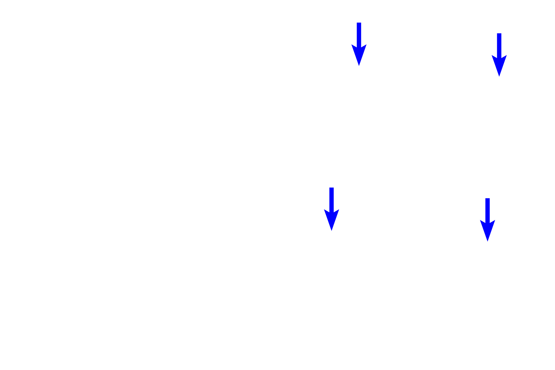  - Subendocardial connective tissue <p>The endocardium lines the heart chambers and is continuous with the tunica intima of blood vessels; it is thicker in the atria than in the ventricles.  The endocardium consists of an endothelium (simple squamous epithelium), an underlying layer of subendothelial connective tissue that may also contain smooth muscle fibers, and a deeper layer of subendocardial connective tissue.  Elements of the conducting system of the heart, Purkinje fibers, are located in the subendocardial connective tissue layer.  10x, 400x, 400x</p>

