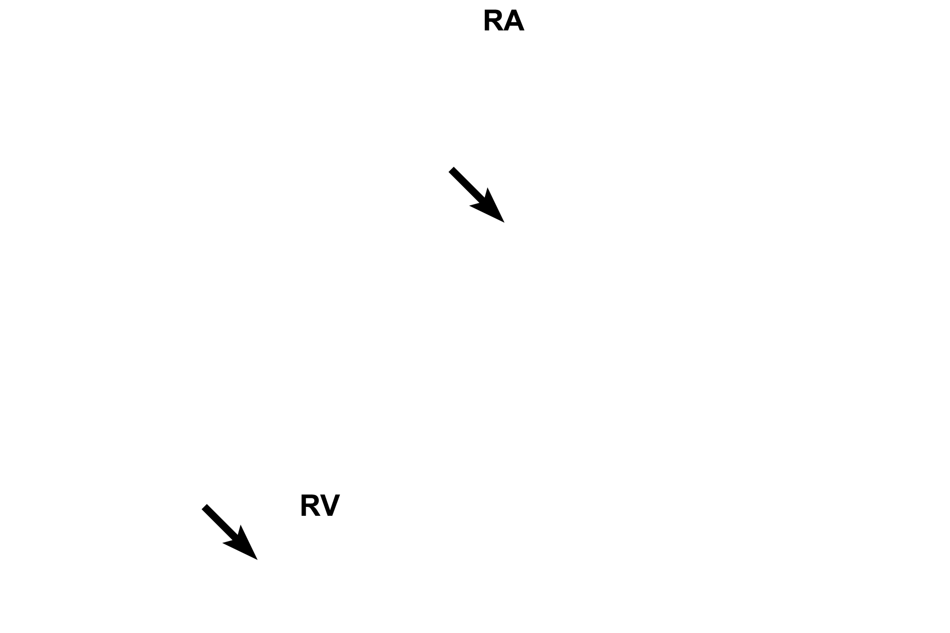 Right atrioventricular valve leaflet > <p>The atrioventricular valve separates the right atrium from the right ventricle.</p>
