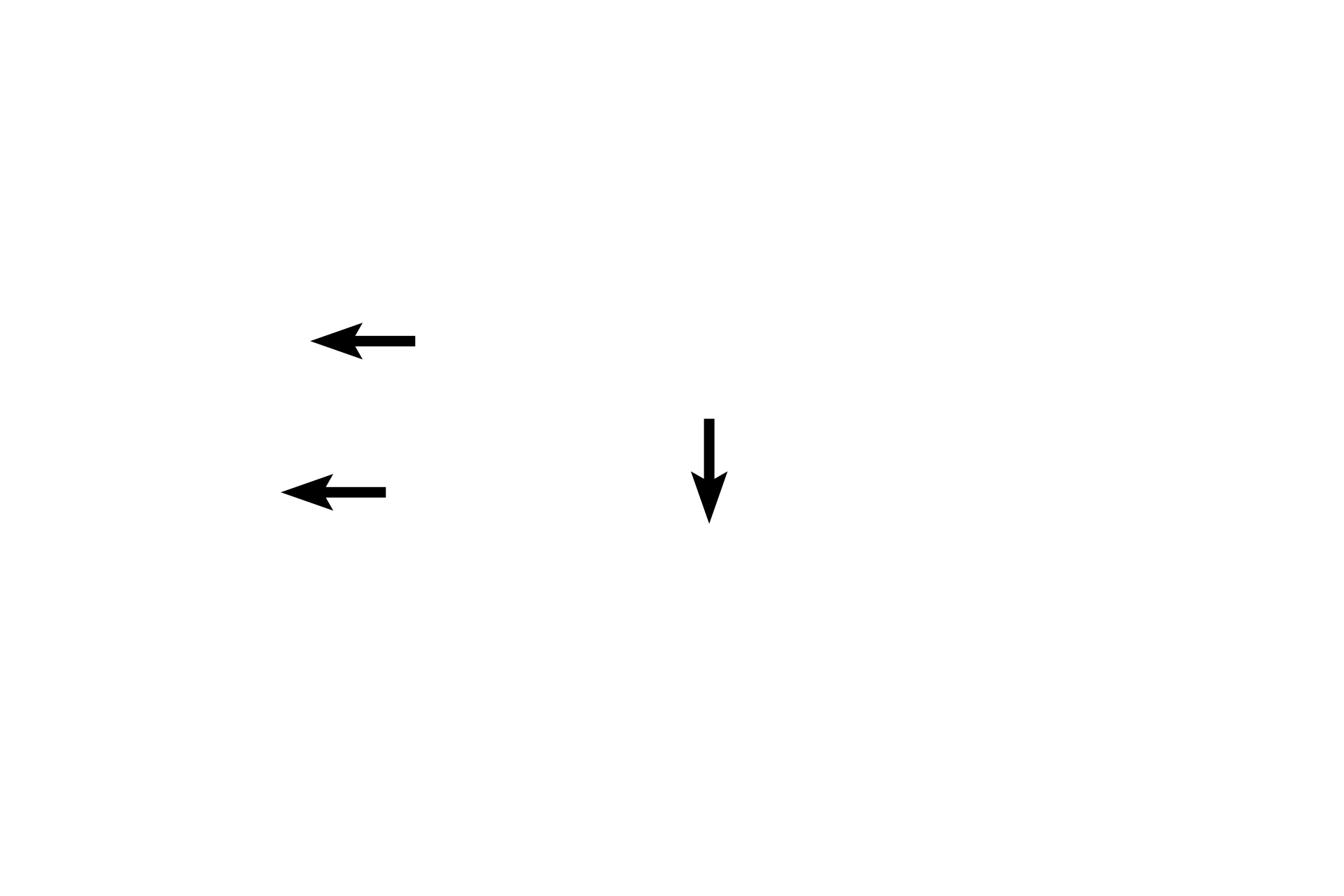 Major calyx <p>Several excretory passages are illustrated.  Minor calyces surround the apices (papillae) of renal pyramids.  Major calyces are formed by the union of several minor calyces.  Two to three major calyces unite to form the enlarged renal pelvis, which continues as the ureter.  The bladder and urethra are not depicted in this image.</p>
