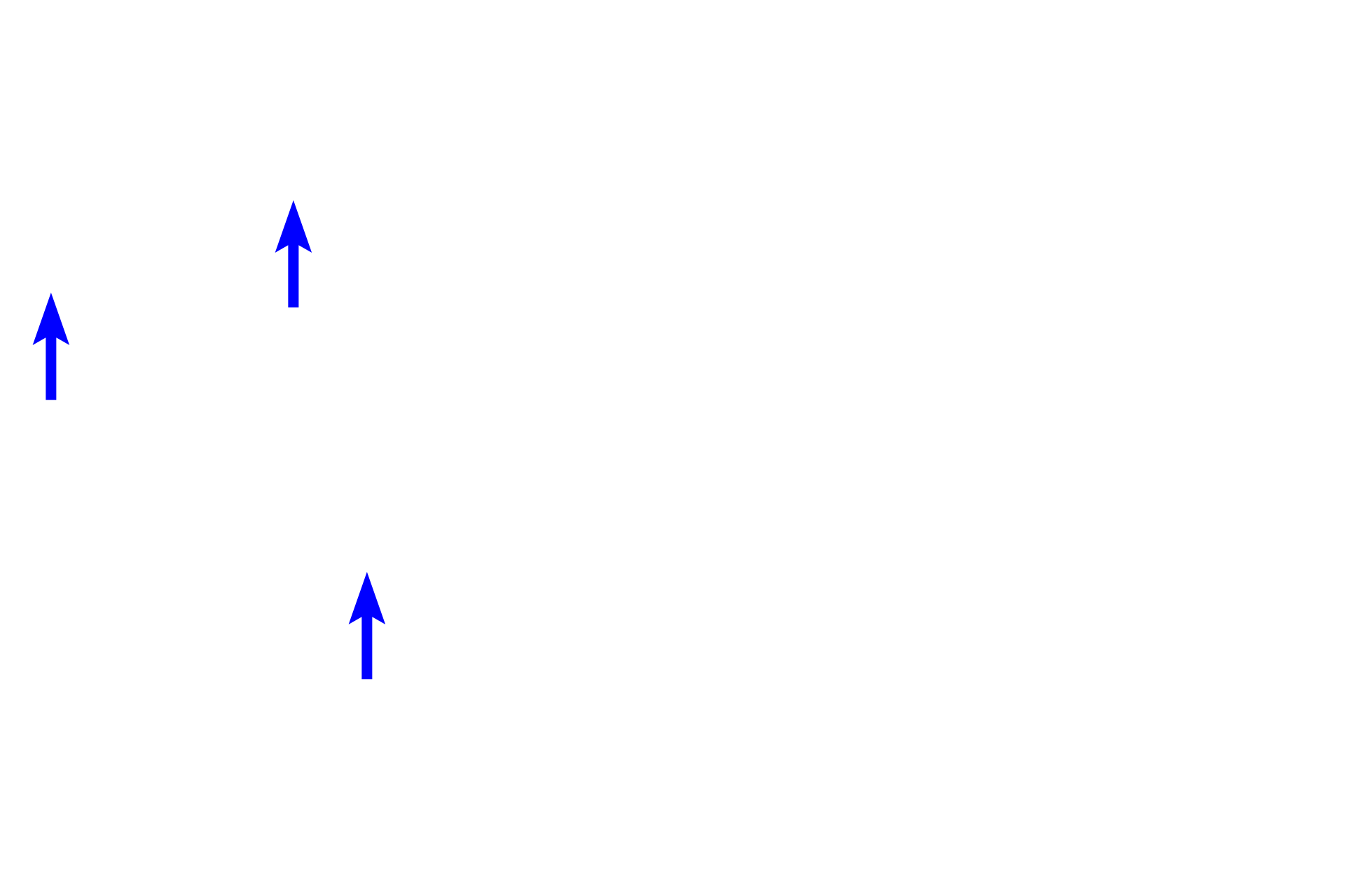  - Renal blood vessels <p>The calyces merge to eventually form the renal pelvis, a portion of which is visible here.  The renal pelvis is the expanded proximal portion of the ureter and lies in the renal sinus along with the major renal blood vessels. </p>
