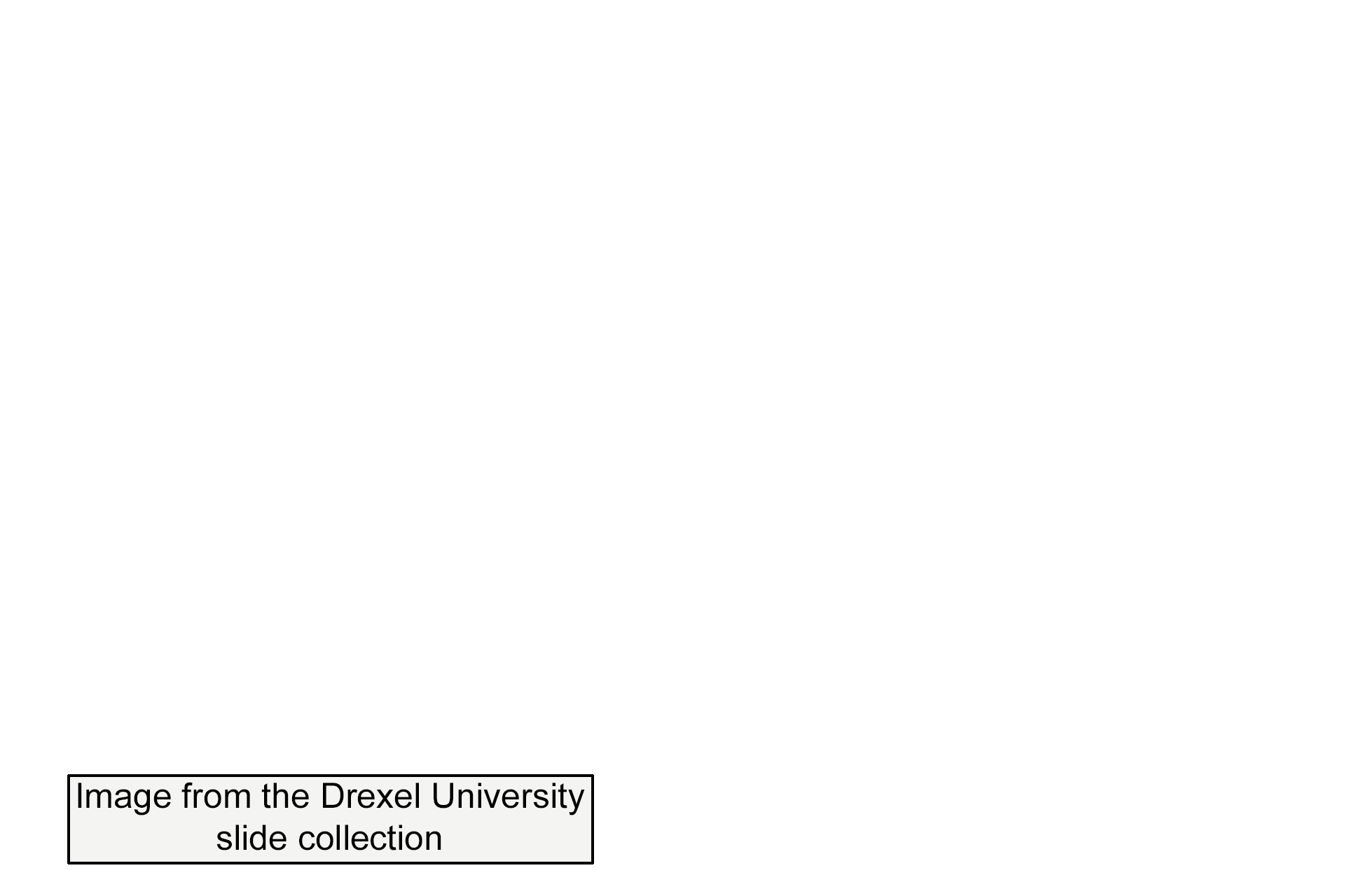 Image source > <p>This image was taken from a slide in the Drexel University slide collection.</p>
