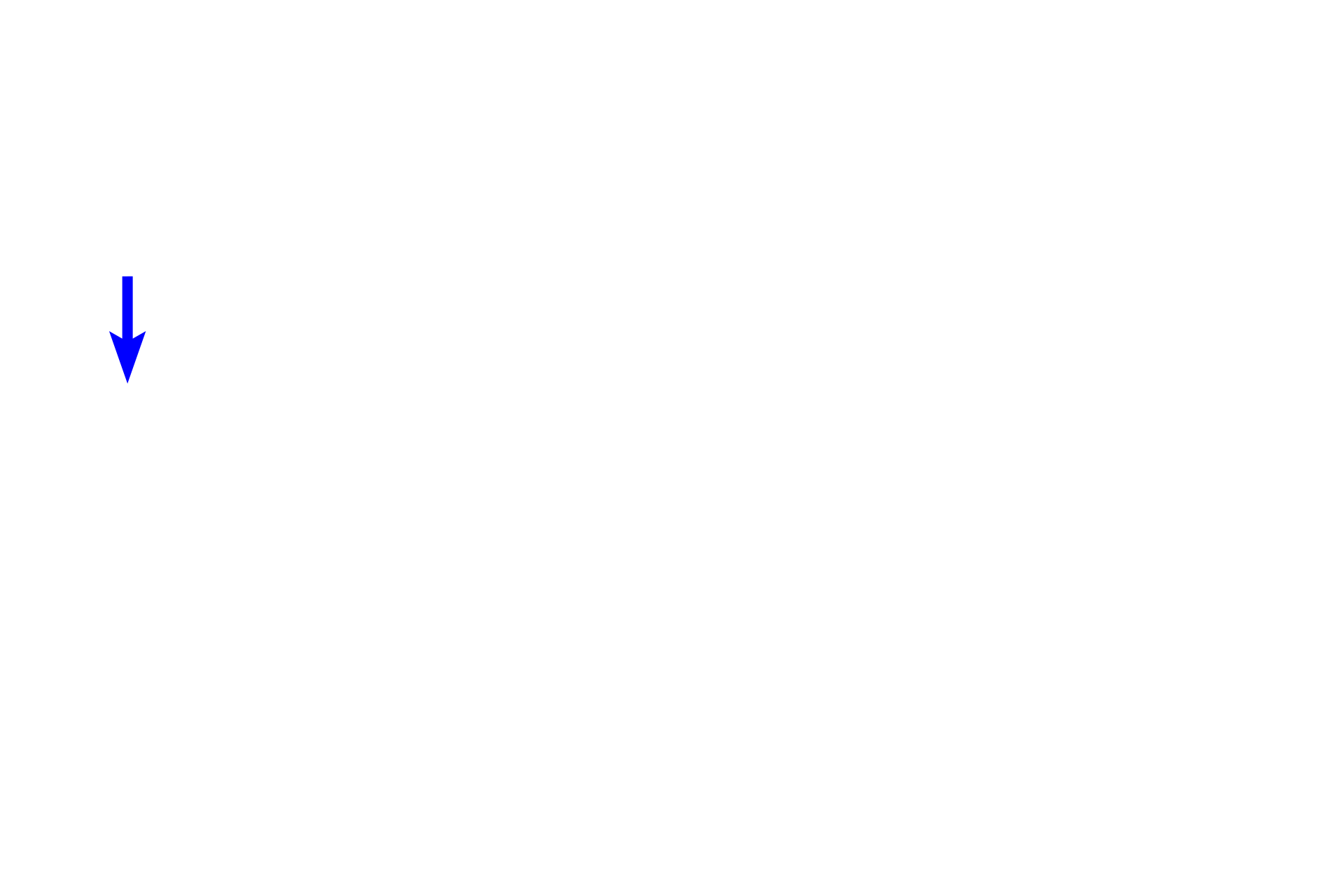  - Renal pelvis > <p>The calyces merge to eventually form the renal pelvis, a portion of which is visible here.  The renal pelvis is the expanded proximal portion of the ureter and lies in the renal sinus along with the major renal blood vessels. </p>
