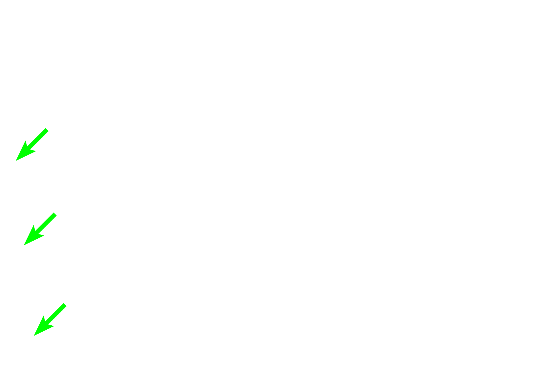 Adventitia <p>The ureter is lined by transitional epithelium overlying a connective tissue layer.  For most of the ureter’s length, the muscularis externa is divided into inner longitudinal and outer circular layers (the reverse of the digestive tract).  However, near the urinary bladder, as seen here, an additional outer longitudinal layer is added.  400x</p>
