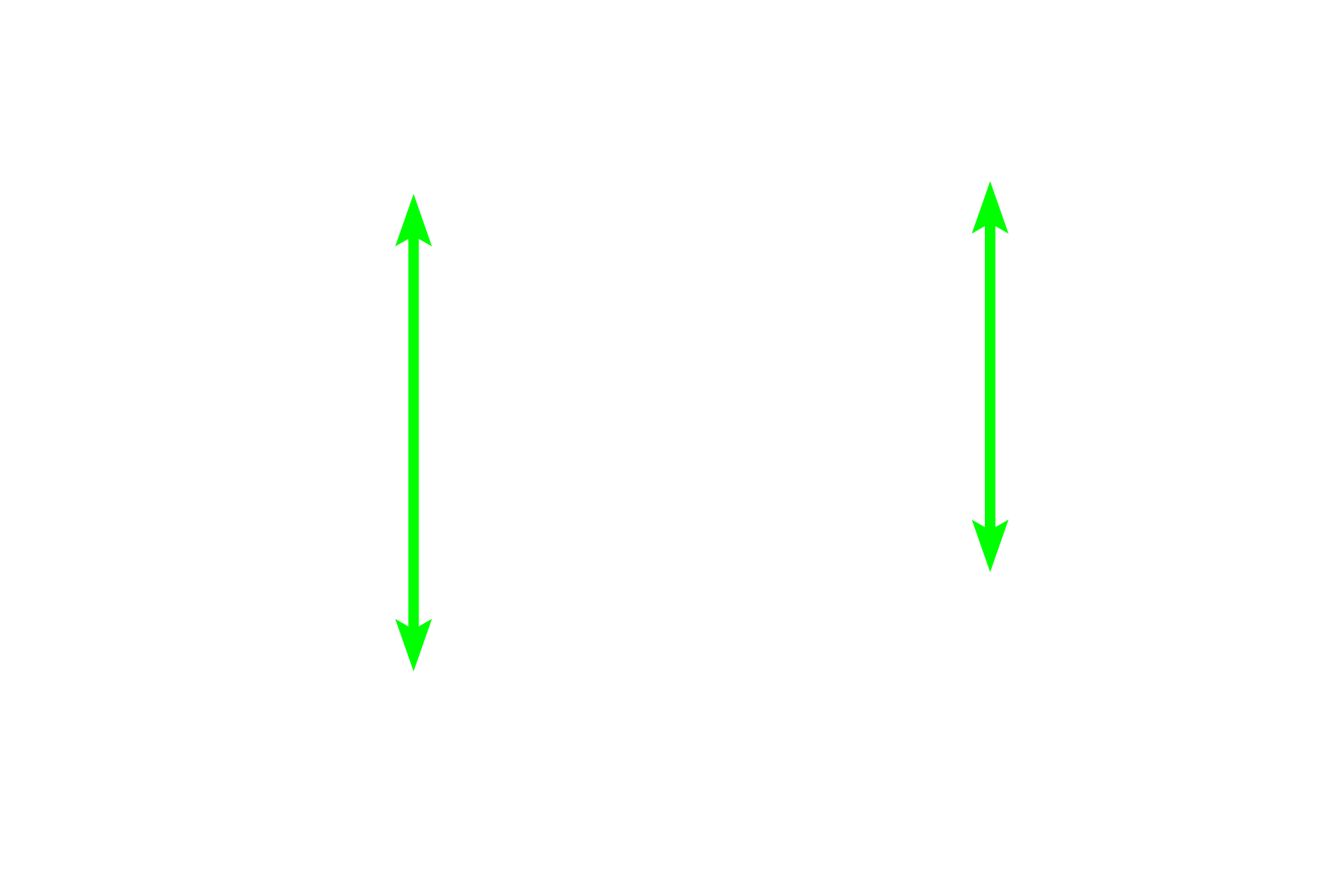 Transitional epithelium <p>The mucosa of the bladder has a histologic appearance very similar to that of the ureter.  Transitional epithelium has characteristic dome-shaped cells at the surface when the bladder is not distended with urine.  Dome cells are often bi-nucleated and become flattened when the bladder is distended.  A connective tissue layer (lamina propria continuous with submucosa) underlies this epithelium.  400x</p>
