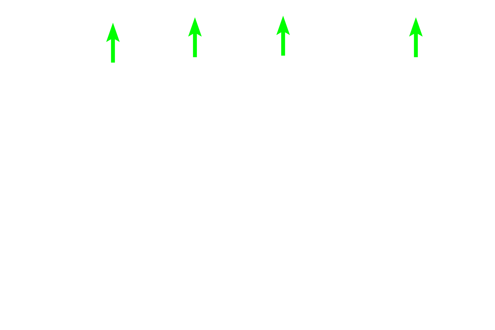 Transitional epithelium <p>The bladder is lined by transitional epithelium.  The underlying lamina is composed of a thinner, highly cellular portion adjacent to the epithelium and a thicker region of dense connective tissue closer to muscularis externa.  The muscularis externa is composed of three ill-defined layers of smooth muscle (inner and outer longitudinal and middle circular layers).  An adventitia is present beyond the muscularis externa.  100x</p>
