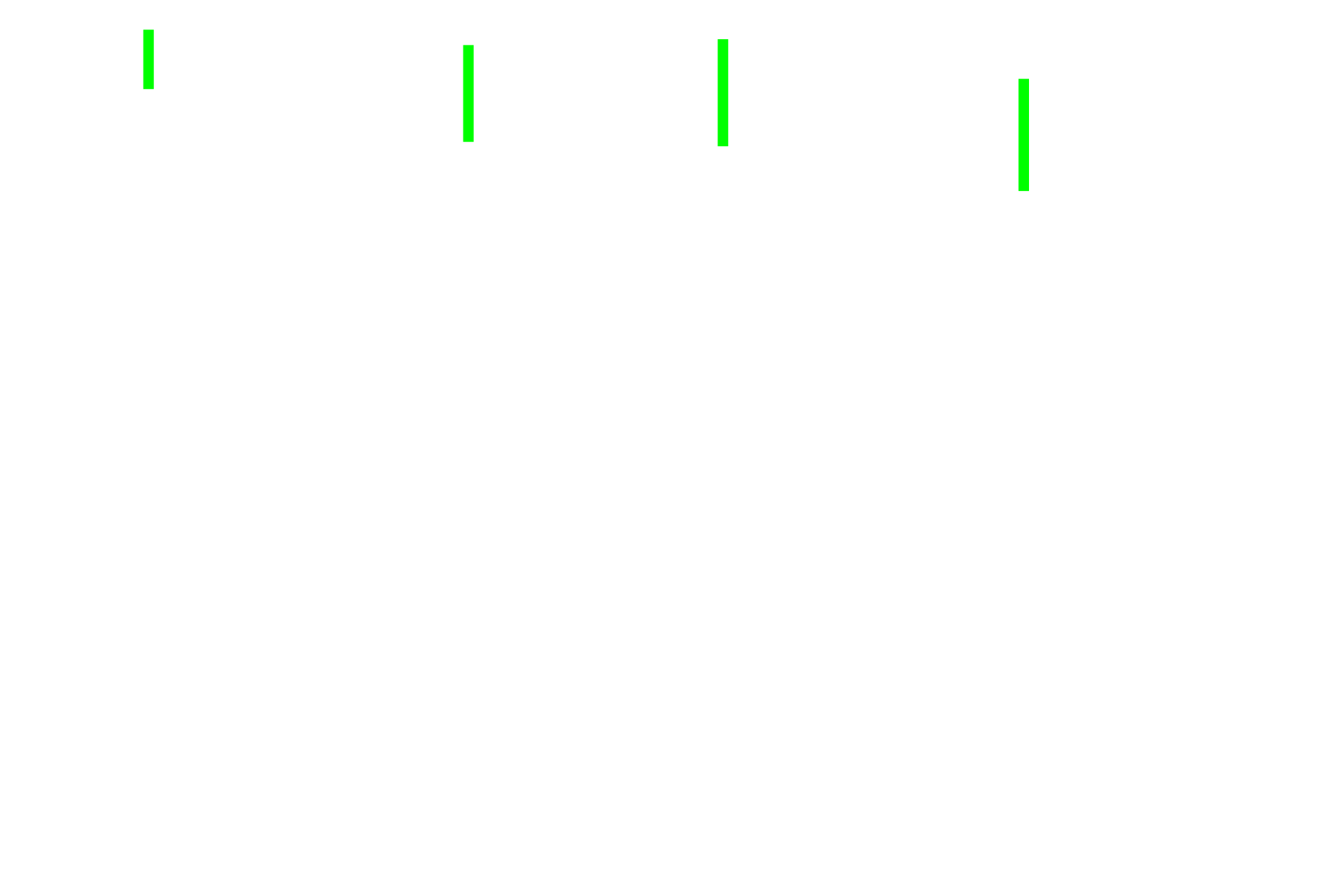 Lamina propria <p>The bladder is lined by transitional epithelium.  The underlying lamina is composed of a thinner, highly cellular portion adjacent to the epithelium and a thicker region of dense connective tissue closer to muscularis externa.  The muscularis externa is composed of three ill-defined layers of smooth muscle (inner and outer longitudinal and middle circular layers).  An adventitia is present beyond the muscularis externa.  100x</p>
