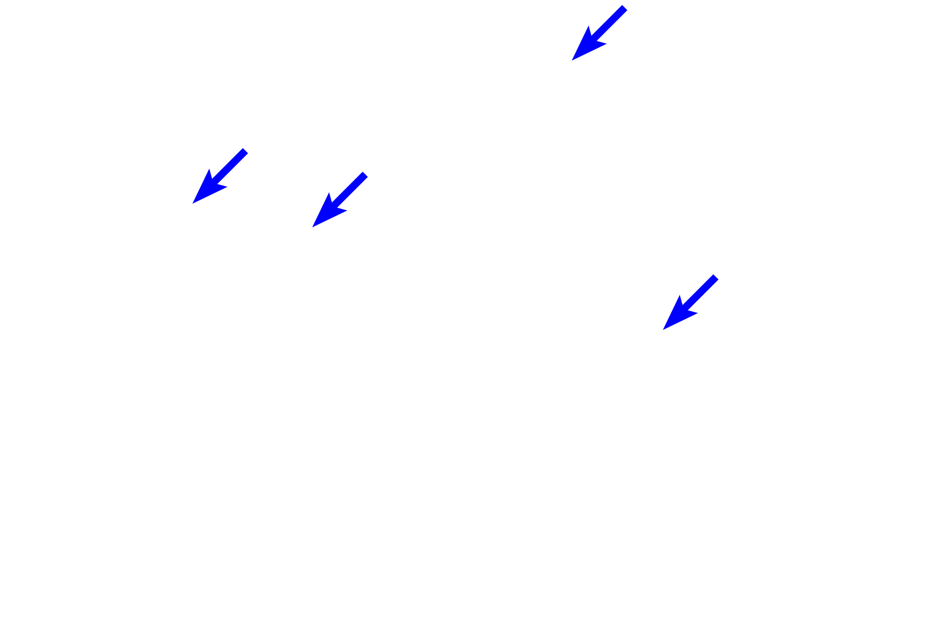 Blood vessels <p>Smooth muscle in the muscularis externa of the urinary bladder is arranged in interlacing fascicles, which do not form the distinct layers present in the digestive system.  300x </p>
