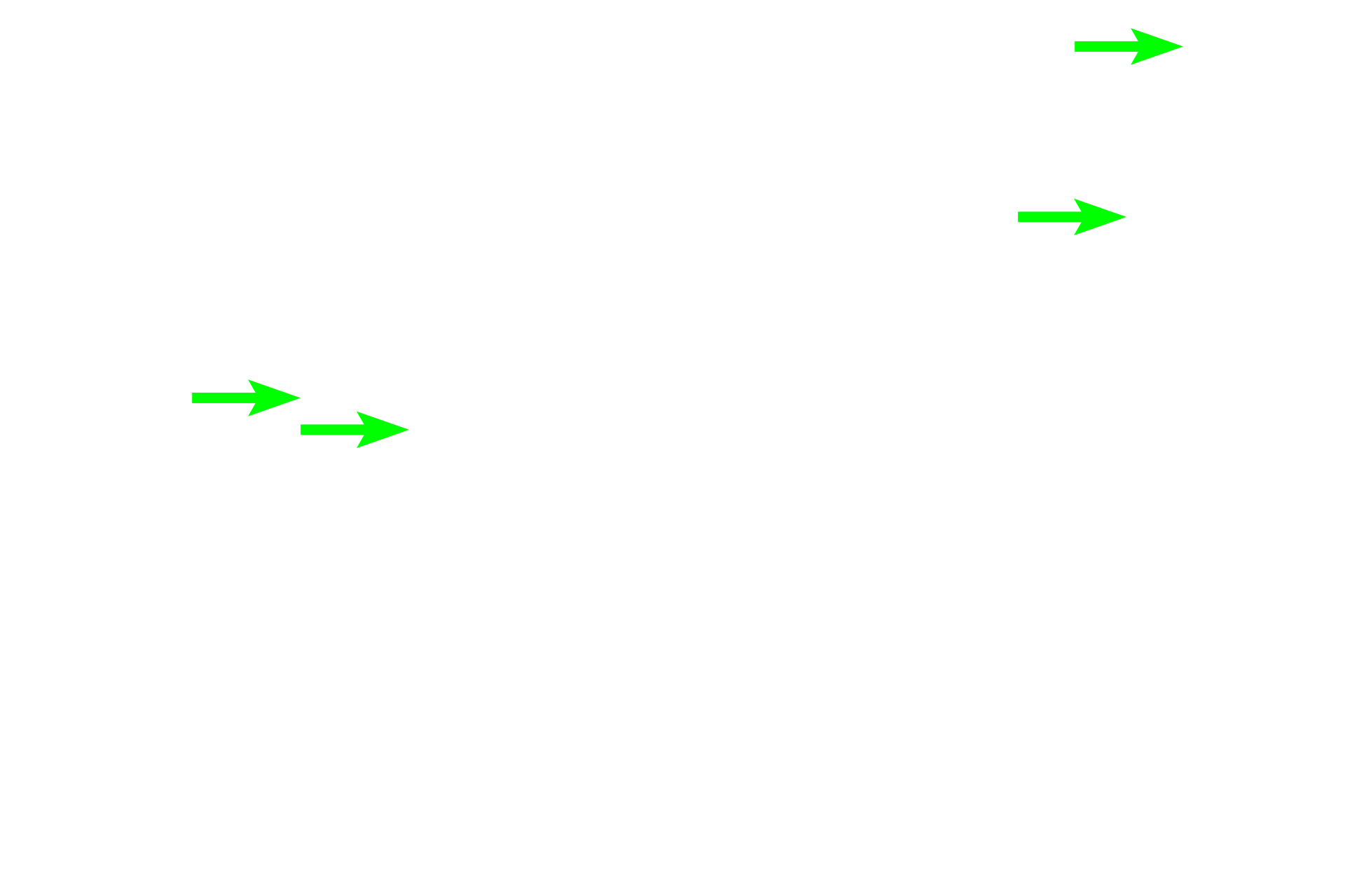  - Stratified squamous moist epithelium <p>The female urethra is much shorter than in males (3-5 cm in length), and its mucosa is thrown into longitudinal folds.  The transitional epithelium present as the urethra exits the bladder transitions to stratified squamous, such as seen here.  The lamina propria contains a venous plexus similar to the male corpus spongiosum.  In addition to two layers of smooth muscle (inner longitudinal and outer circular), an outermost layer of circular, skeletal muscle is present at the distal end.  200x, 400x</p>
