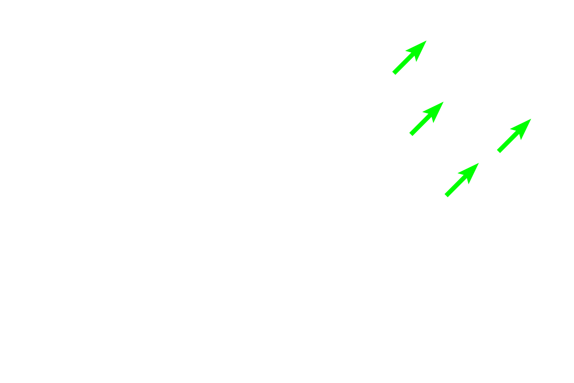  -- Venous plexus <p>The female urethra is much shorter than in males (3-5 cm in length), and its mucosa is thrown into longitudinal folds.  The transitional epithelium present as the urethra exits the bladder transitions to stratified squamous, such as seen here.  The lamina propria contains a venous plexus similar to the male corpus spongiosum.  In addition to two layers of smooth muscle (inner longitudinal and outer circular), an outermost layer of circular, skeletal muscle is present at the distal end.  200x, 400x</p>
