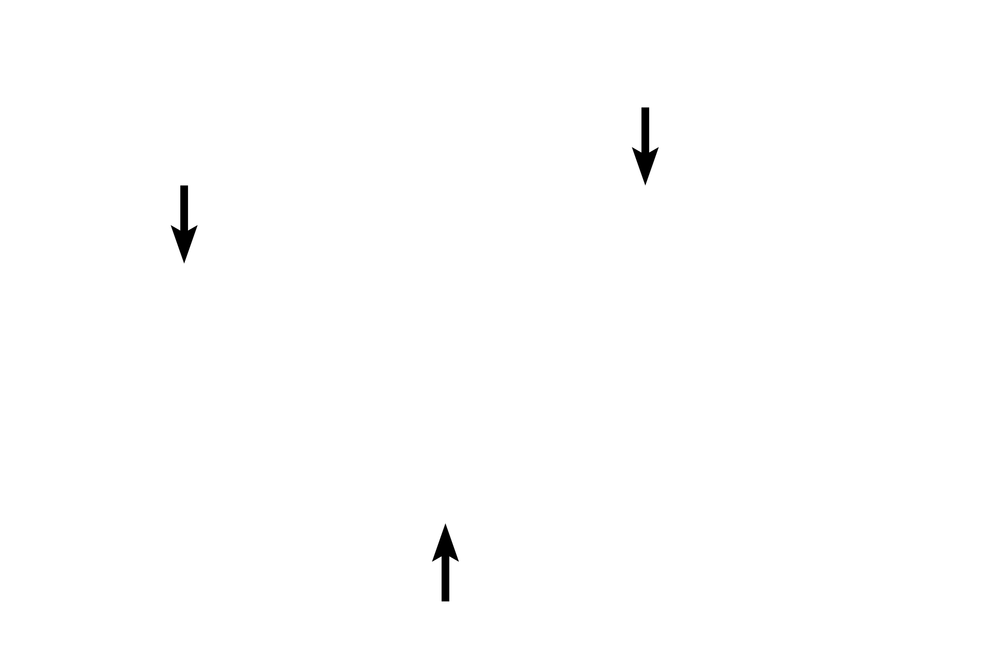 Middle circular muscle <p>The neck of the bladder, located at its inferior pole, is a short region that precedes the prostatic urethra in males. Like the rest of the bladder, this region is lined by transitional epithelium. The muscular layer, consisting of inner and outer longitudinal layers and a middle circular layer, is well developed, so that its contraction causes the mucosa to become highly folded. 100x</p>
