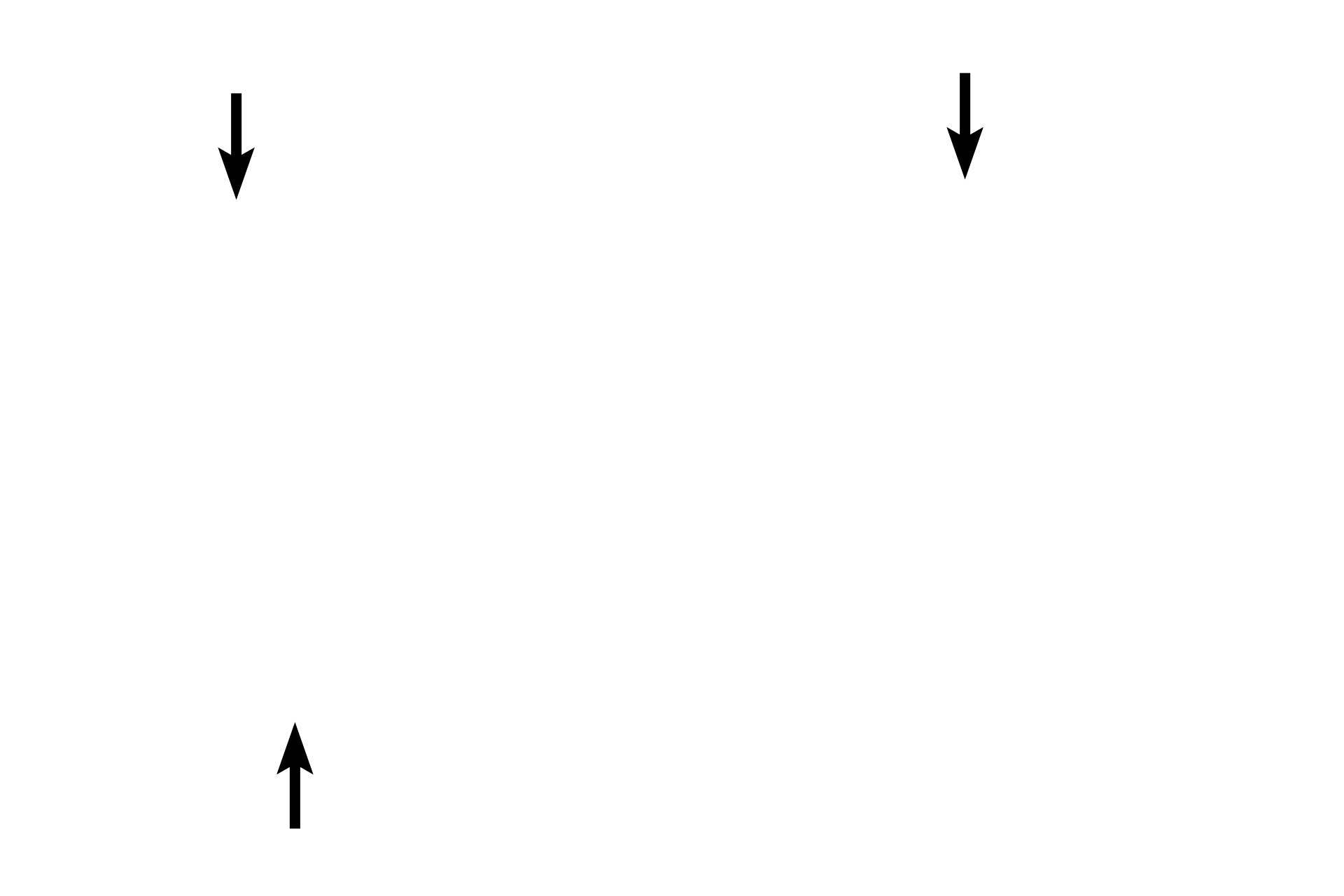 Outer longitudinal muscle <p>The neck of the bladder, located at its inferior pole, is a short region that precedes the prostatic urethra in males. Like the rest of the bladder, this region is lined by transitional epithelium. The muscular layer, consisting of inner and outer longitudinal layers and a middle circular layer, is well developed, so that its contraction causes the mucosa to become highly folded. 100x</p>
